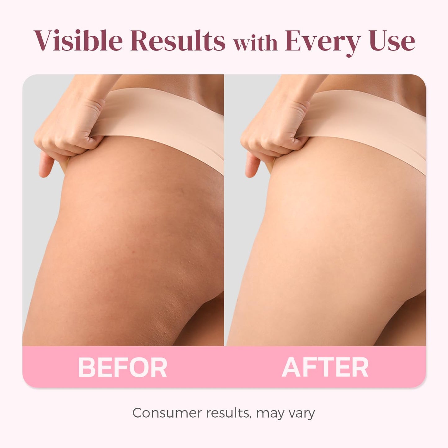 Butt Tight Lift and Firm Booty Cellulite Cream - Smooth & Sculpt Booty, Thighs, Belly & Arms | LIFTONIN® Skin Firming & Toning Bum Mask 3.72 fl oz