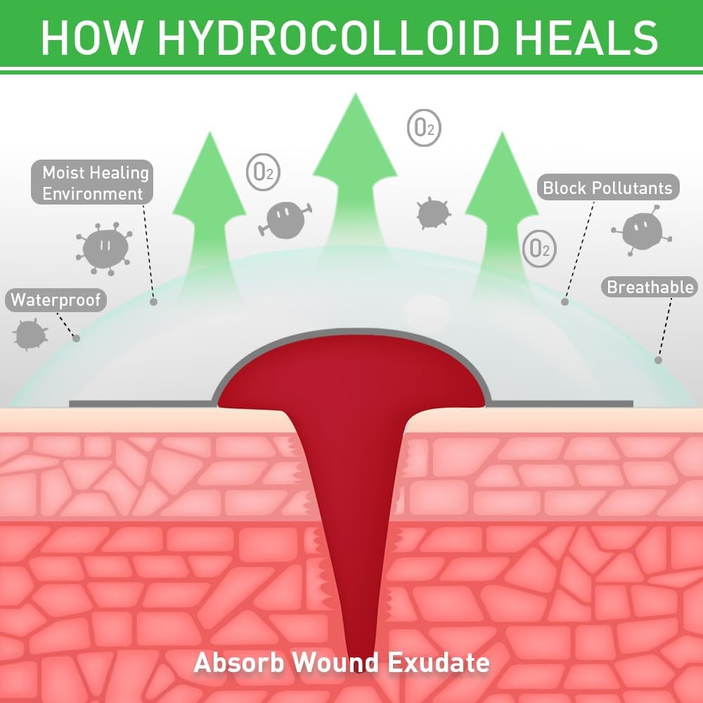 Hydrocolloid Roll for Wound Care 2in*12ft, Large Hydrocolloid Bandages Patch with Self-Adhesive Waterproof Ultra Absorbent Flexible DIY Size & Shape First Aid Kit Essential