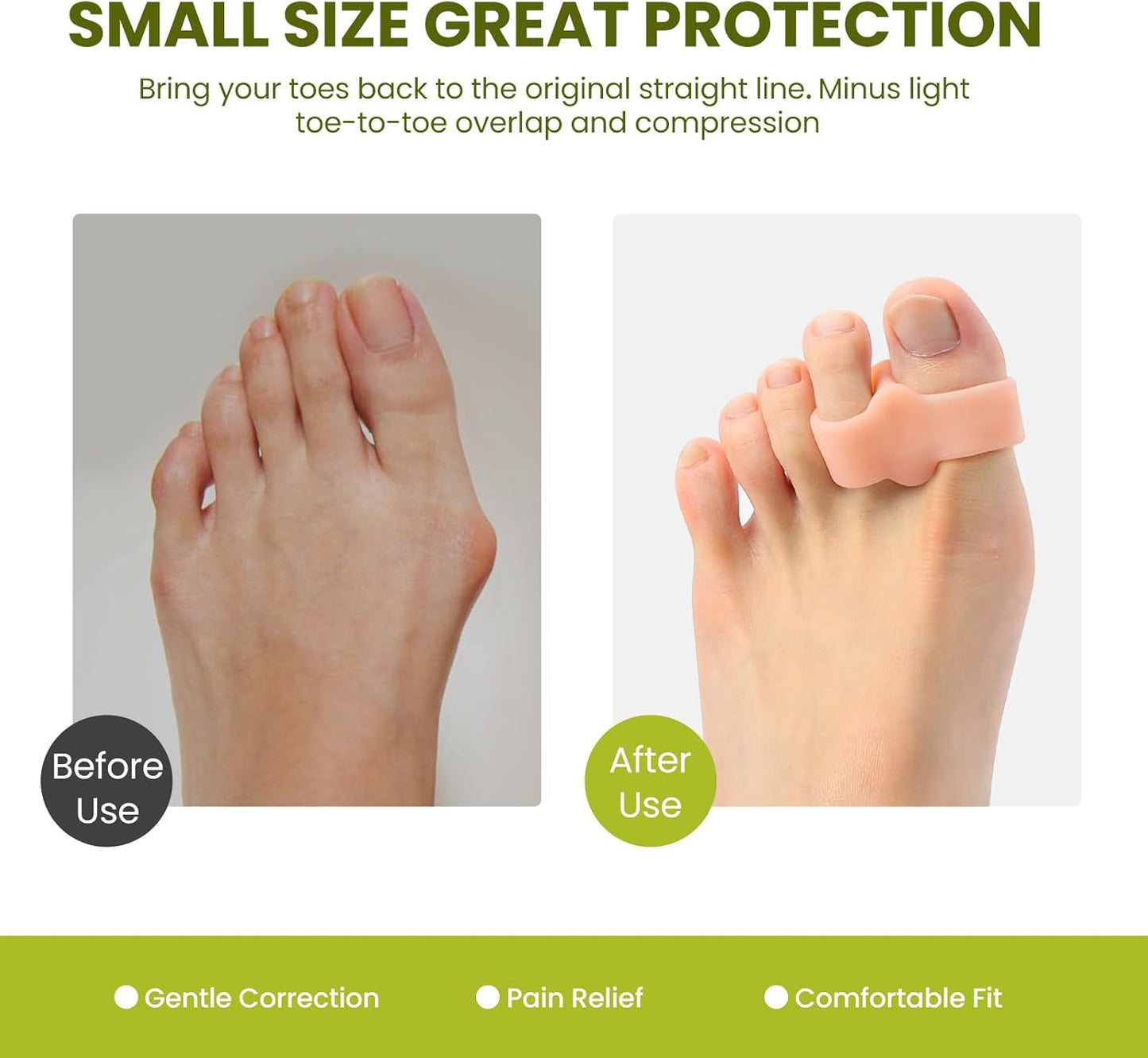 Bukihome Pack of 8 Bunion Corrector, Toe Separators with 2 Loops, Big Toe Spacer Suitable for Bunion and Overlap Toe (Beige)