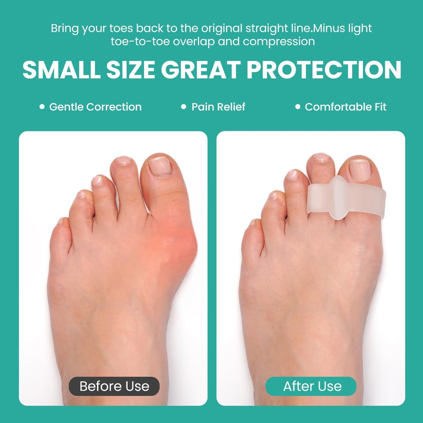 Welnove Pack of 12 Bunion Corrector, Toe Separators with 2 Loops, Big Toe Spacer Suitable for Bunion and Overlap Toe, Infused Aloe Vera Extract (Clear)