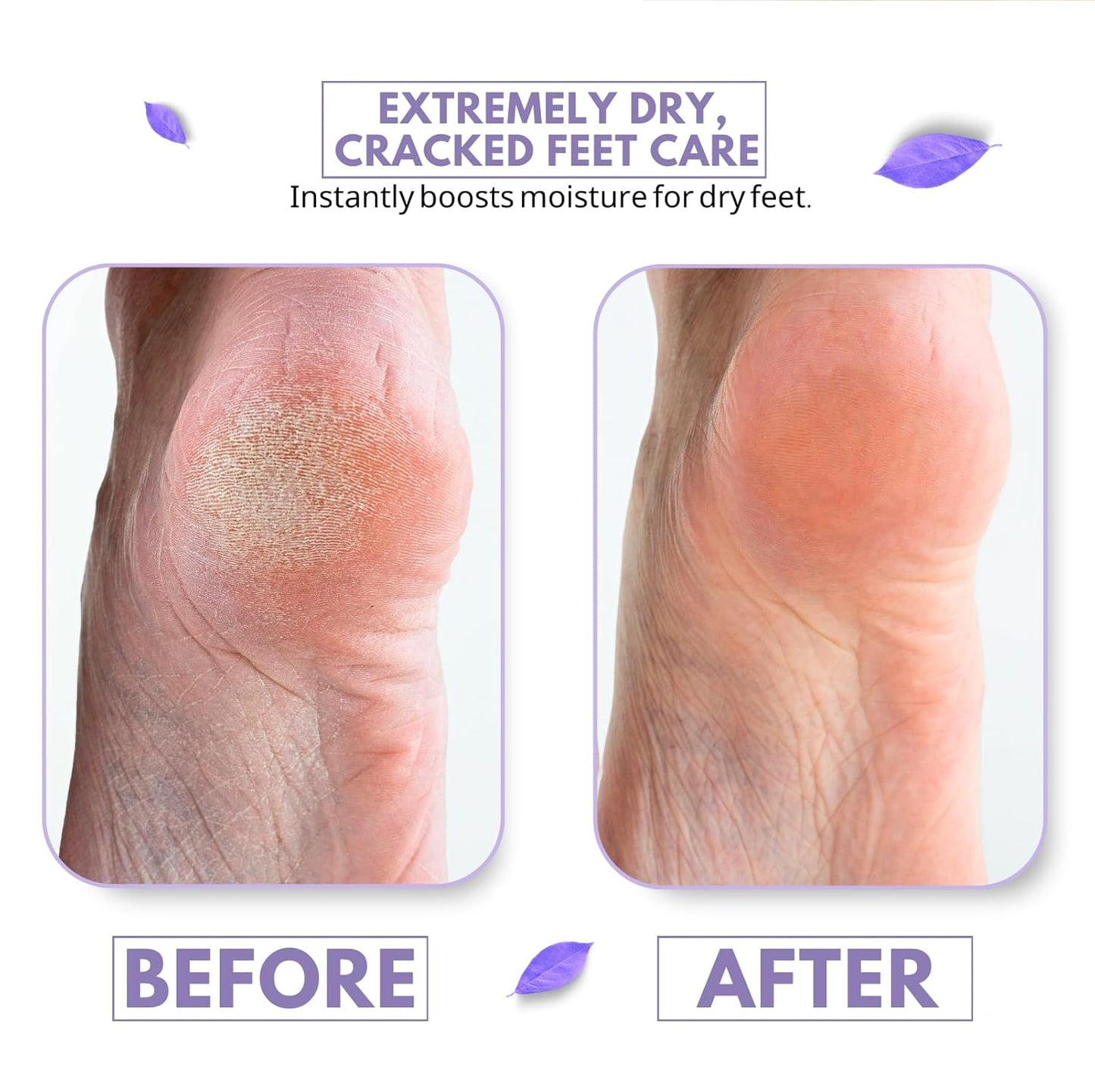 Foot Deodorant Cream for Long-Lasting Odor Control (Neutralizes Odor at the Source) (Hydrates Dry, Cracked Feet) with Natural Mushroom Extract,