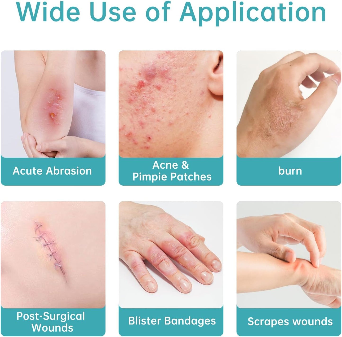 Hydrocolloid Roll for Wound Care Edge-Peel with edges, (2in*16ft)Cut-to-Size Extra Large Hydrocolloid Patch Bandages with Self-Adhesive, Ultra Absorbent, Flexible Waterproof, First Aid Kit Essential