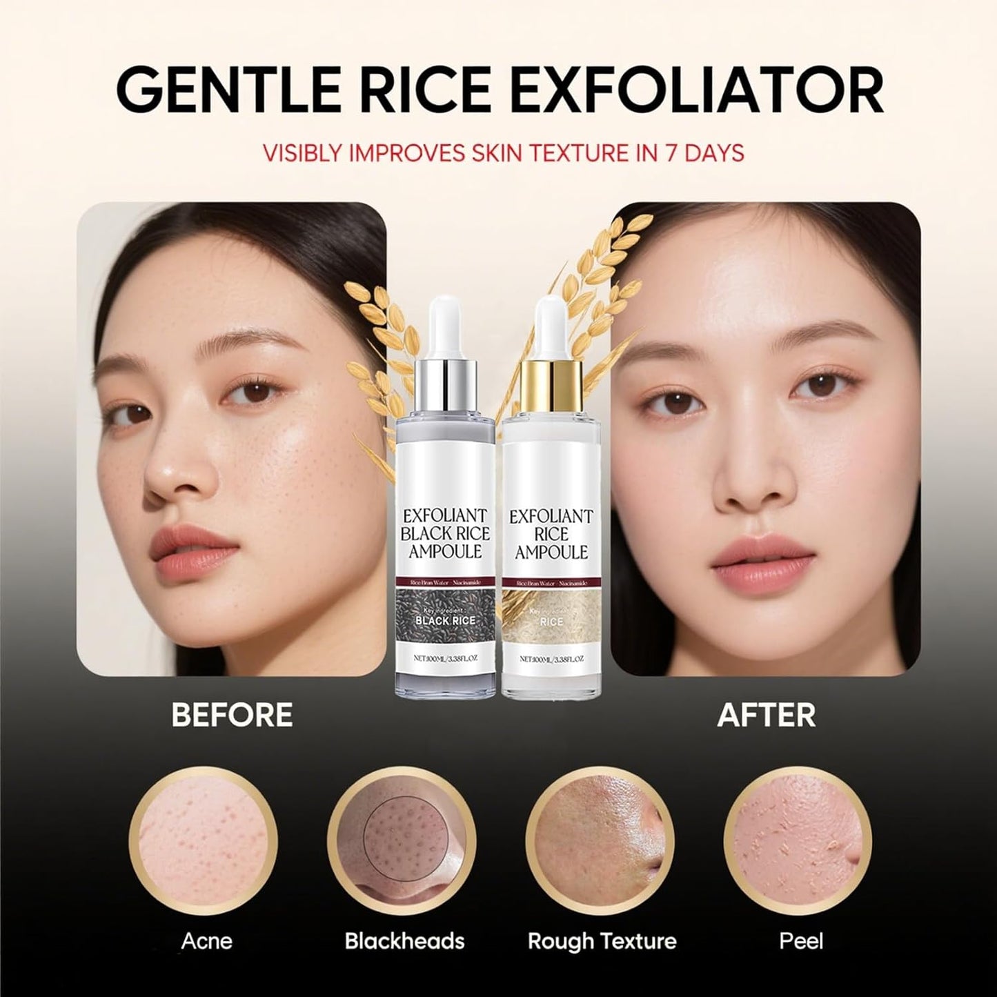 Glow Rice Ampoule Duo Day & Night - 2PCS White & Black Rice Peeling Ampoule for Face & Body, Gentle Peel to Remove Dead Skin & Blackheads, Rejuvenating Hydration Exfoliant for All Skin Types 100ml