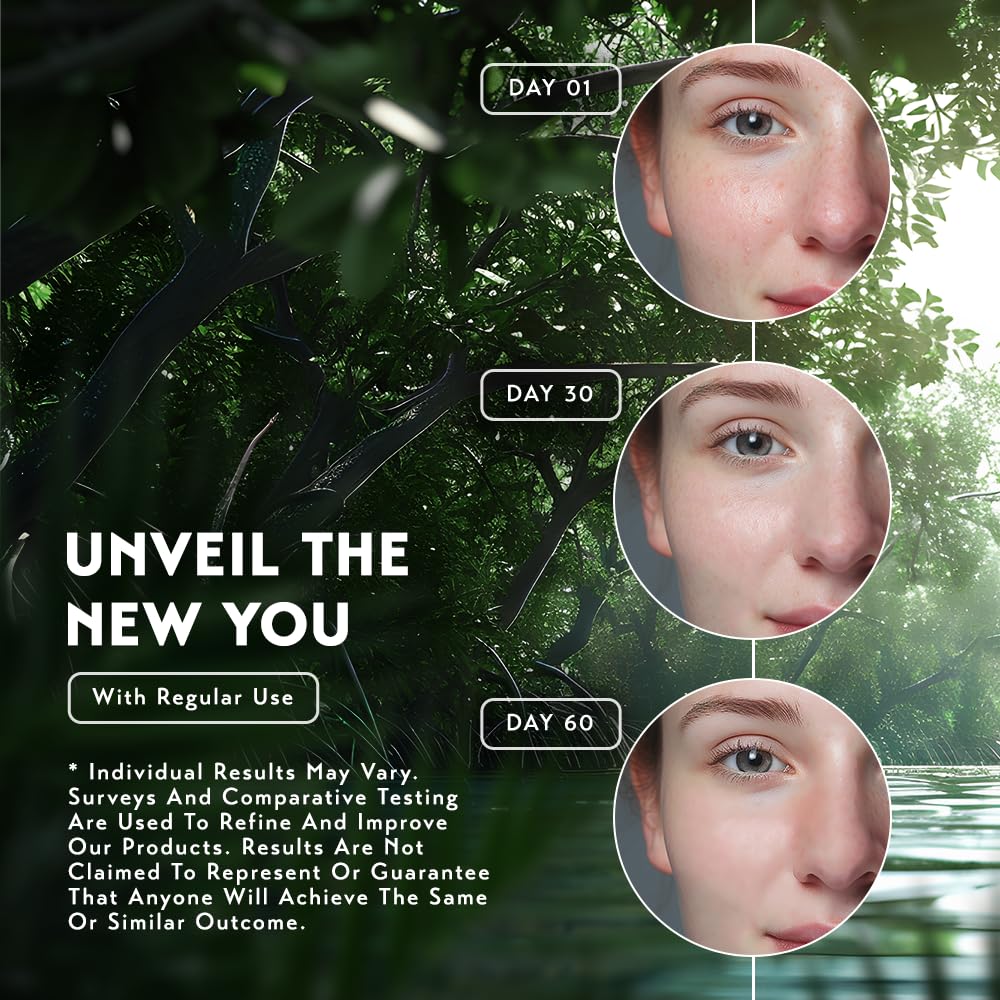 O NATURALS 100% Natural Bar Kojic Acid Soap - Gift Set - Organic Ingredients & Essential Oils - Spa Gifts for Women & Men, Body Wash - 4PC Turmeric