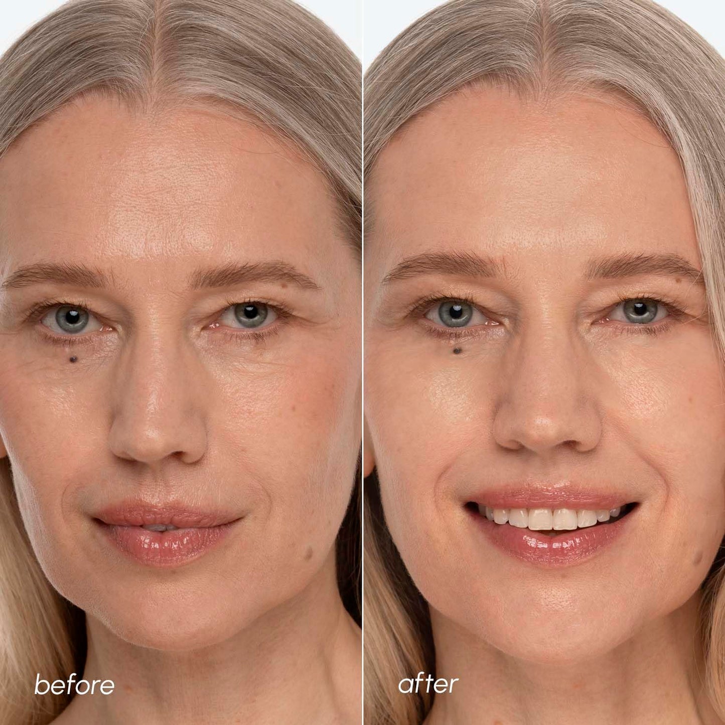 MAREE Collagen Acne Clearing Polishes - Toner Pads with Retinol - Minimizing Wrinkle Zero Pore Pads - Hydrating Toning Collagen Pad with Retinol & Centella Device - Anti Aging Brightening Wipes