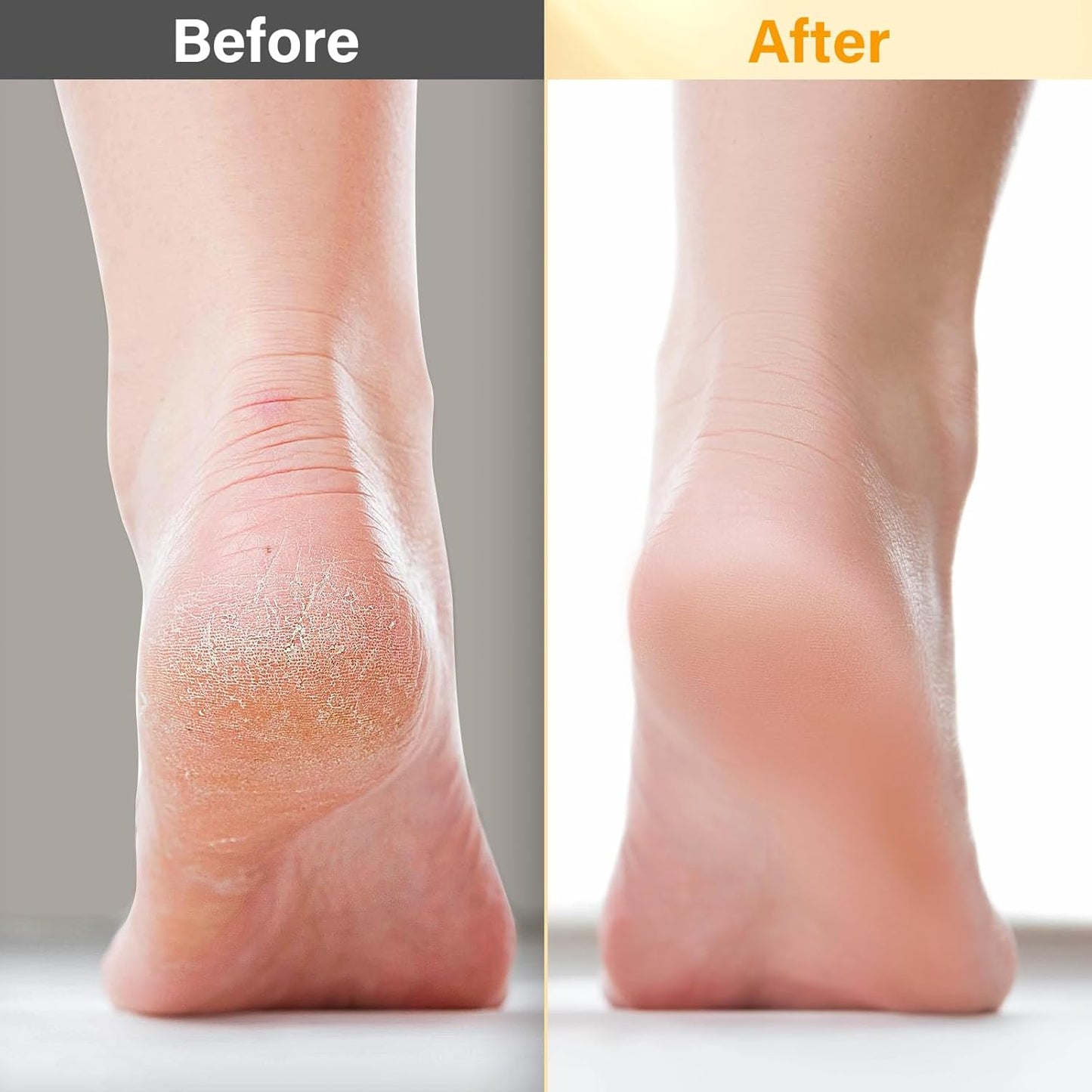 Pedicure Kit For Feet 5pcs Foot Spa Set For Christmas Birthday Valentine's Mother's Day Women Wife Girlfriend Gift Rose Lavender Foot Soak Salt Foot Callus Remover Gel Foot Rasp Foot Cream Foot Care