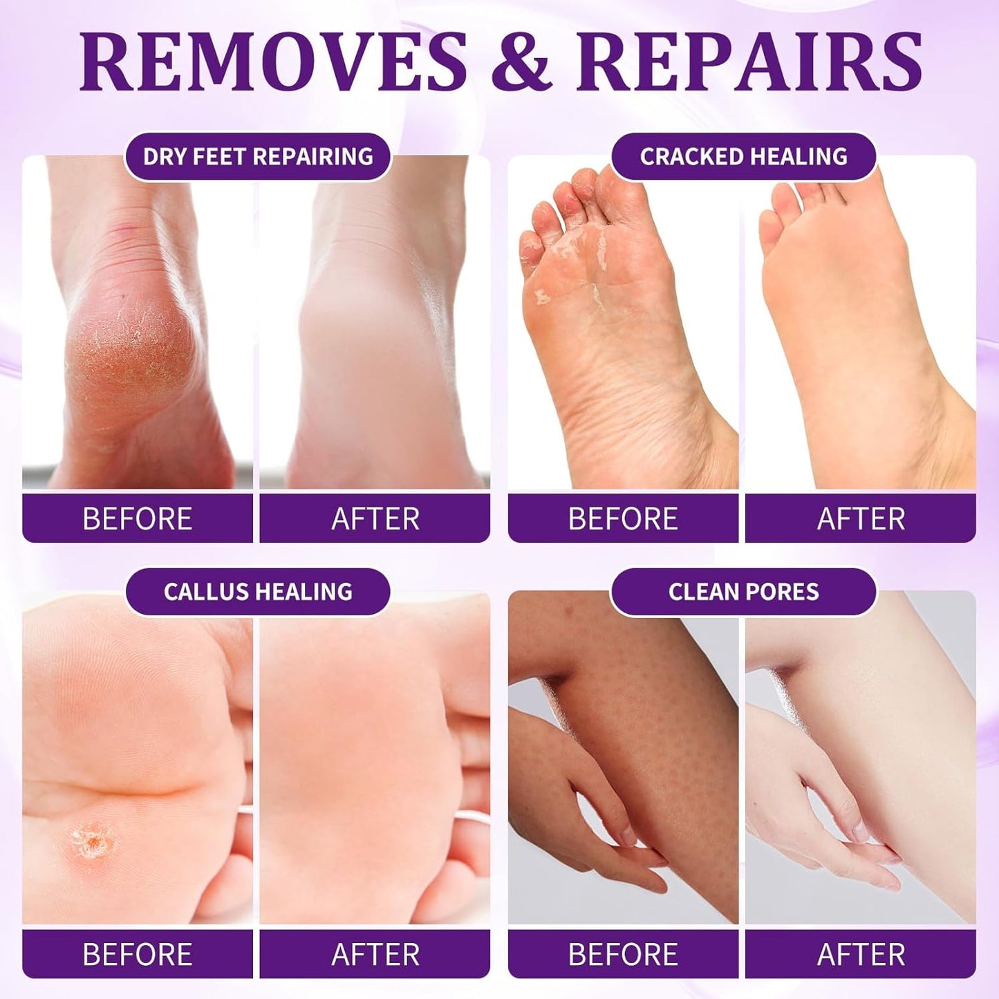 Pedicure Kit Foot Soak Set: Bubble Salt, Sugar Scrub, Massage Mask, Massage Lotion in a Box, 4 Step Foot Spa Kit for Dry Feet, Softens Calluses, Tired Feet(3 Set Lavender)