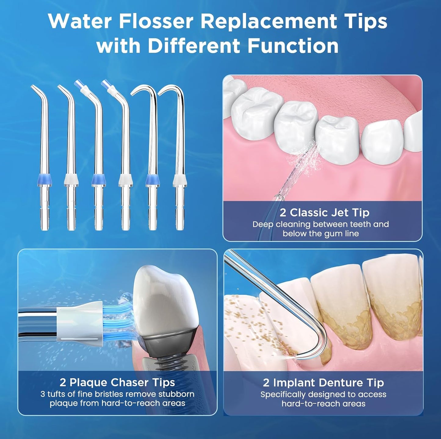 Replacement Tips for Waterpik, Water Flosser Replacement Heads Parts for Waterpik Oral Irrigator(2 Classic Jet Tips + 2 Plaque Chaser Tips + 2 Implant Denture Tips + Storage Case Combo)