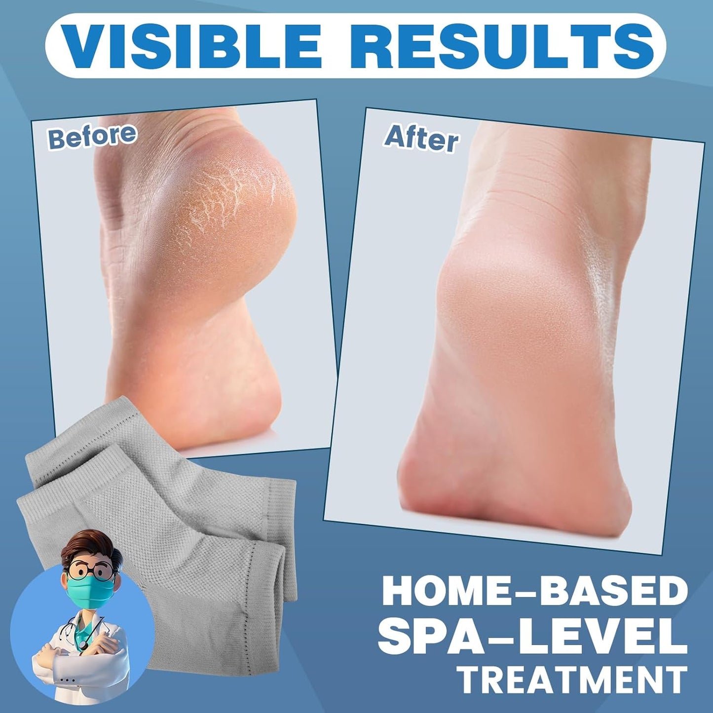 6 Pairs Moisturizing Heel Socks for Cracked Heel Treatment, Foot Care Toeless Socks to Soften and Hydrate Dry Cracked Feet Heels, Cracked Heel Repair Socks, Gel Socks for Dry Cracked Feet