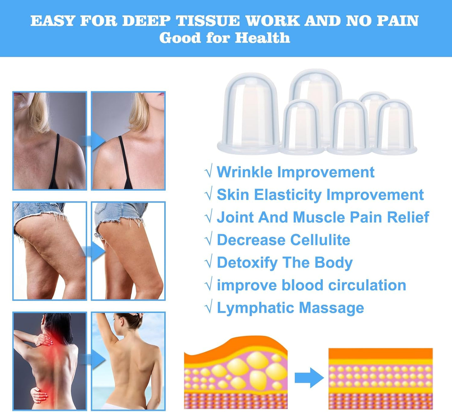 Silicone Cupping Therapy Set - Cupping Kit for Massage Therapy - Cellulite Remover Cupping Set - Anti Cellulite Cup Massager, Vacuum Suction Massage Cups for Cellulite Reduction