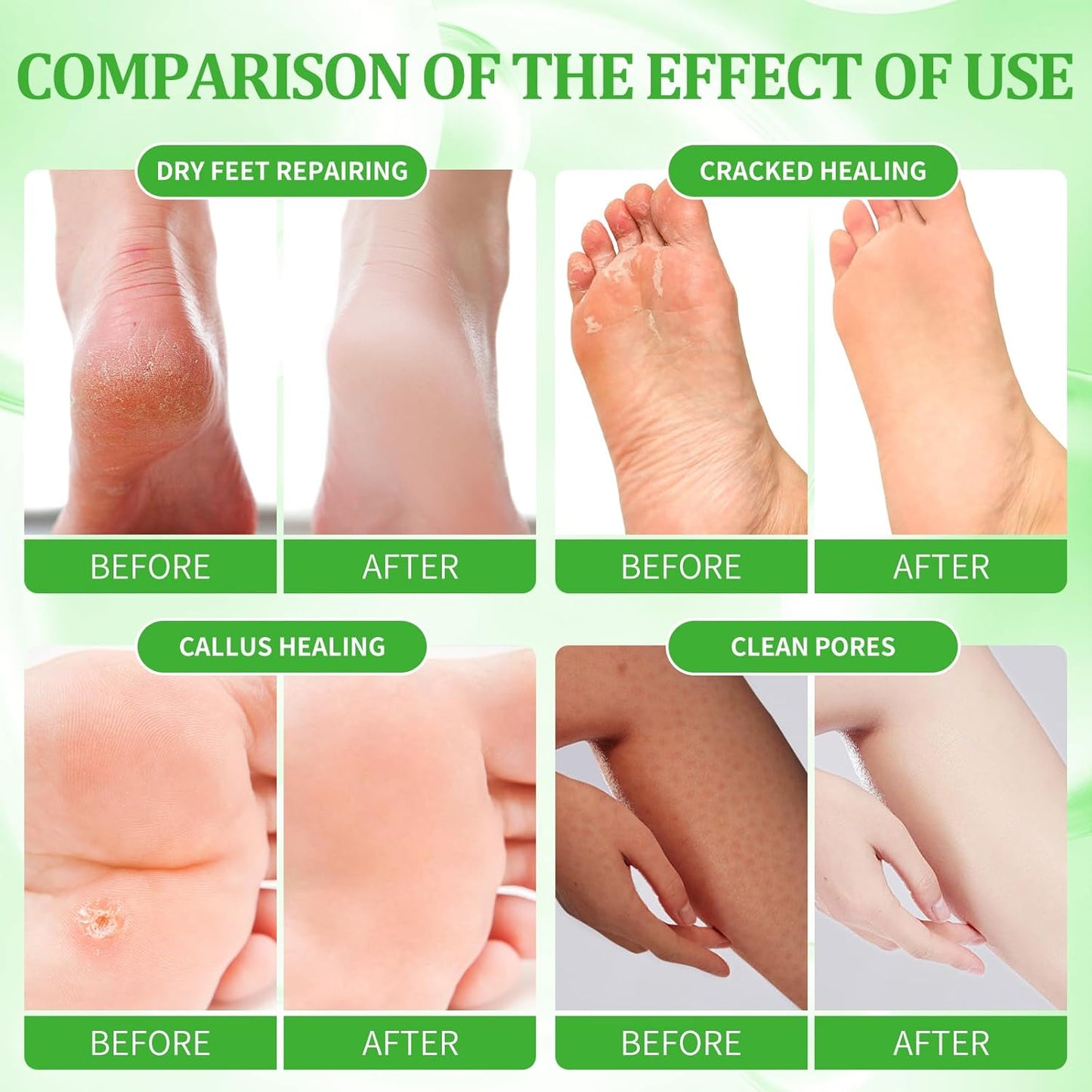 Pedicure Kit Foot Soak Set: Bubble Salt, Sugar Scrub, Massage Mask, Massage Lotion in a Box, 4 Step Foot Spa Kit for Dry Feet, Calluses and Tired Feet(3 Set Peppermint)