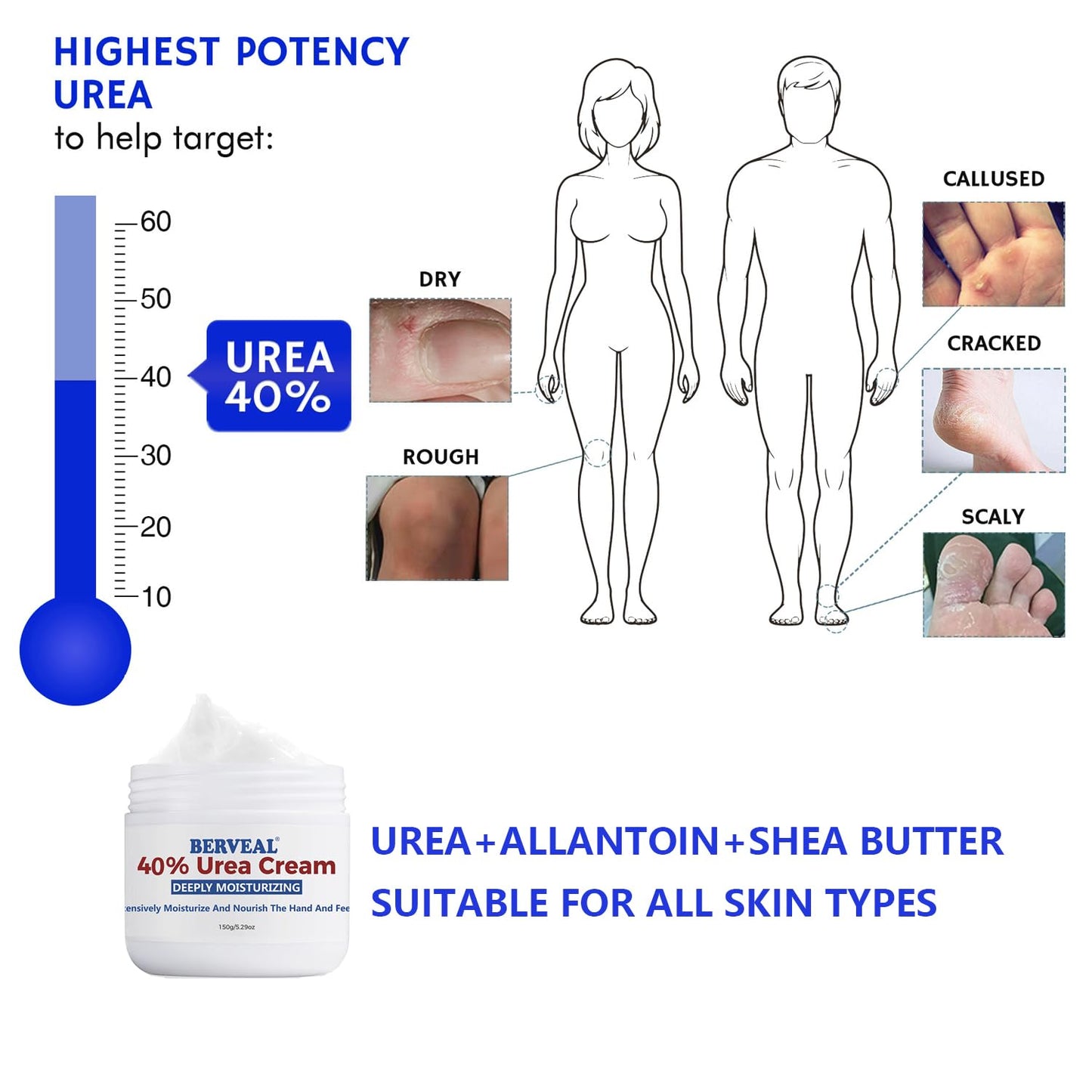 Urea Cream foot cream, 40 percent Foot Care Lotion for Cracked Heels,Moisturizing,Cracked Heels, Ultra,Rough, Dry, Calloused Feet,Softening Rough skin on feet for All Skin 5.29 fl.oz