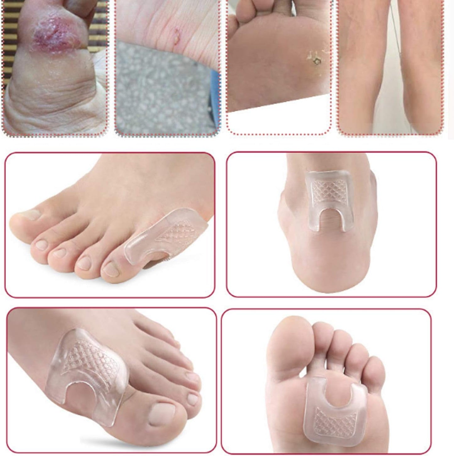 10 Pieces Waterproof Toe Cushions Pads, U-Shaped Gel Callus Pads from Rubbing, Reusable Callus Cushions