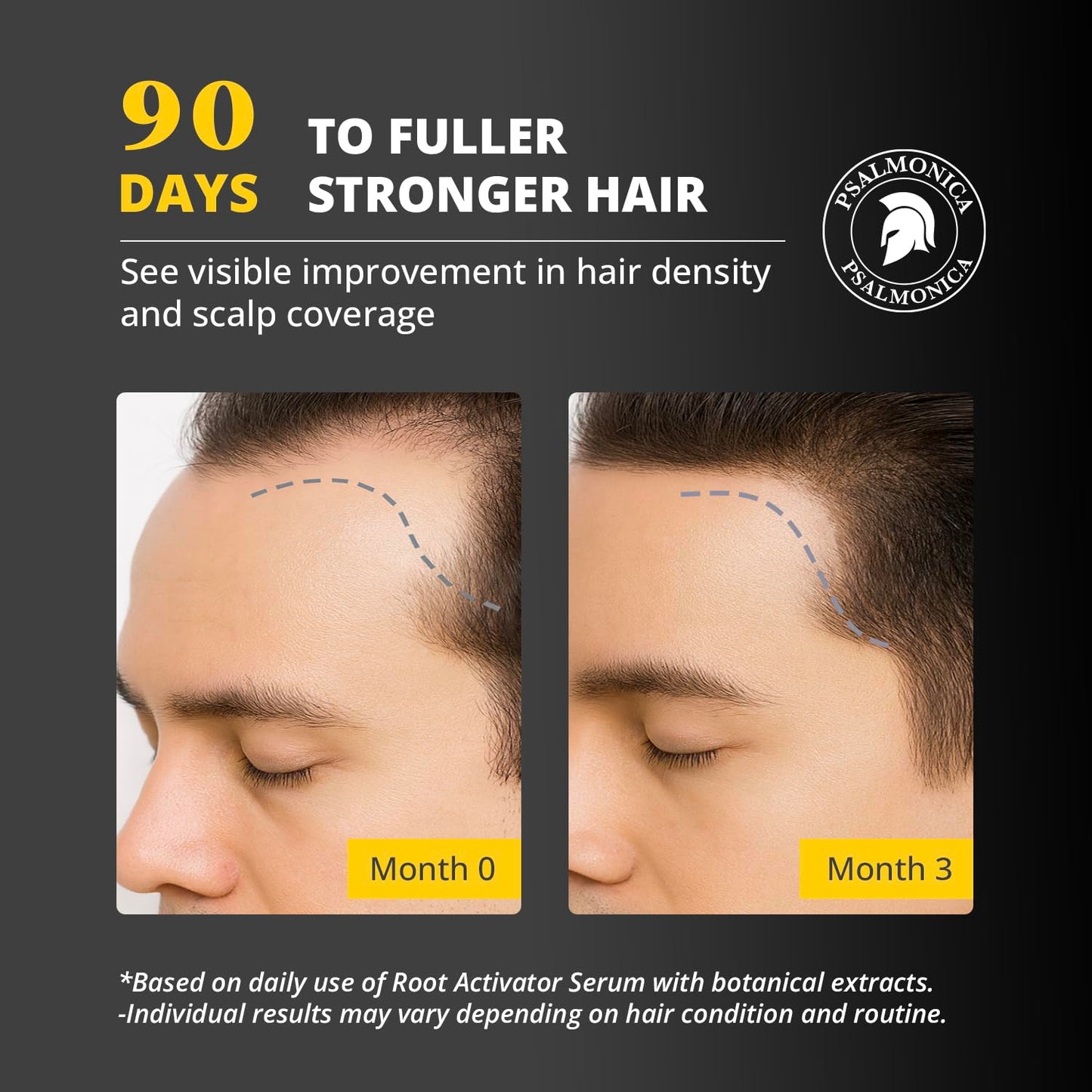 Hair Growth Serum: Root Activator Scalp Serum for Hair Loss and Regrowth Treatments – Natural Hair Oils for Hair Growth for Men Women (1 Fl Oz (Pack of 1))