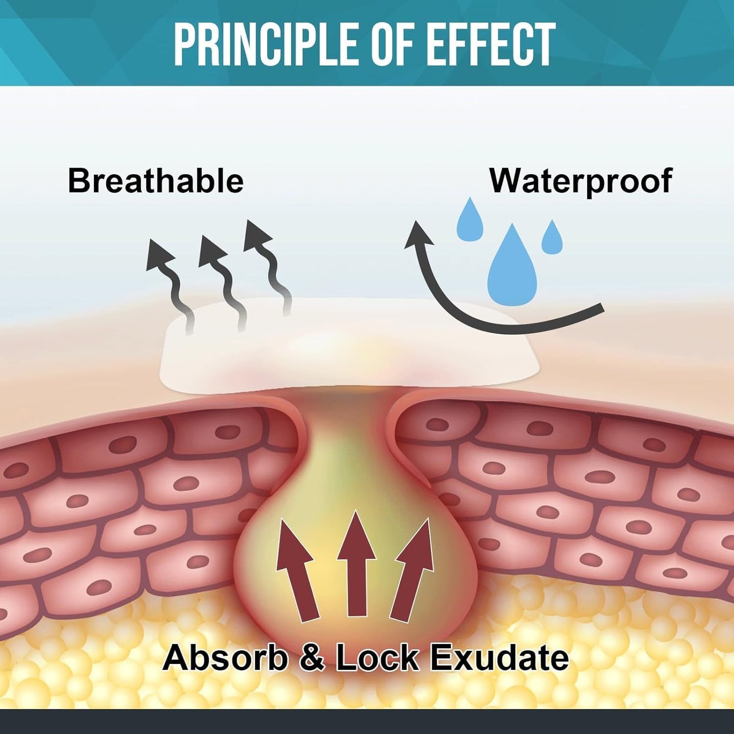 20 Pack Hydrocolloid Wound Dressing, 4" x 4" Ultra Thin Hydrocolloid Bandages with Self-Adhesive, Waterproof Hydrocolloid Patch for Bed Sore, Mild Burn, Blister, Acne Care