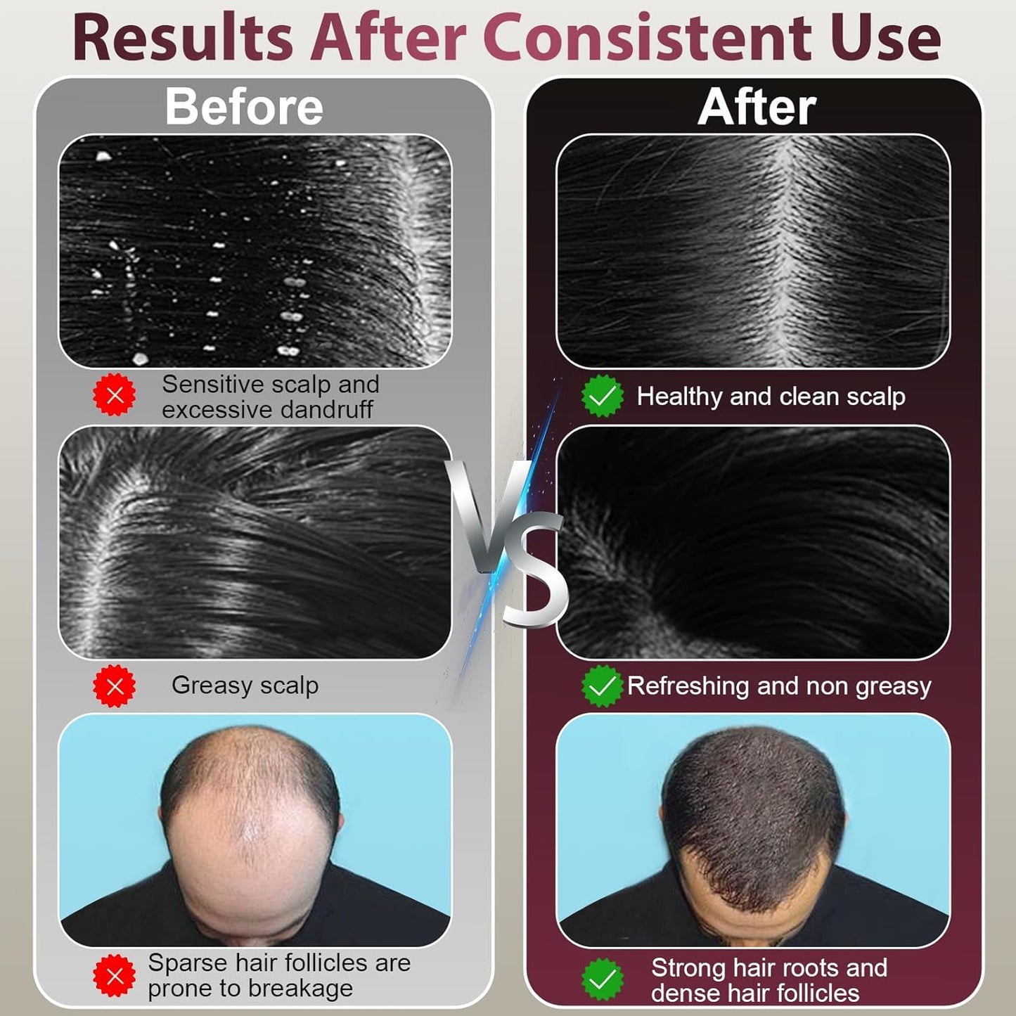 Laser Therapy Hair Growth Comb, Hair Oil Applicator,Electric Scalp Massager Hair Growth with IPX7 Waterproof