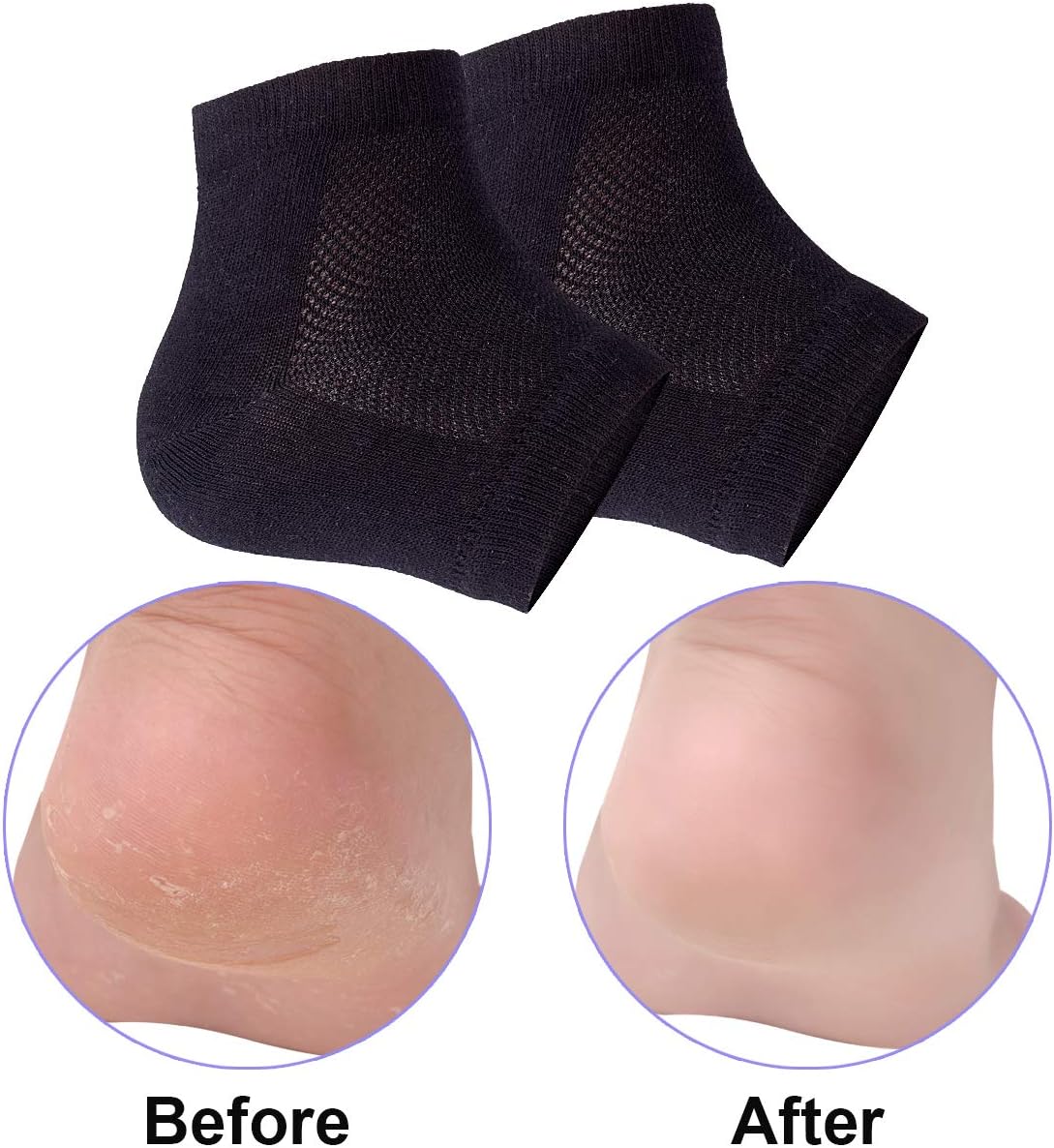 Vented Moisturizing Gel Heel Socks, 3 Pairs Toeless Spa Sock for Foot Care Treatment, Cracked Heels, Dry Feet, Foot Calluses (Black)