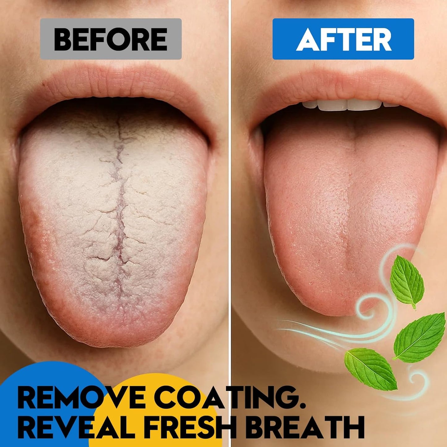 Stainless Tongue Scraper Set for Adults: Easy To Use For Oral Care and Hygiene – Pack Of 2 Stainless Steel Tongue Cleaners, 2 Travel Cases, 4 Floss Picks – Cleaning for Tongue Care & Fresh Breath