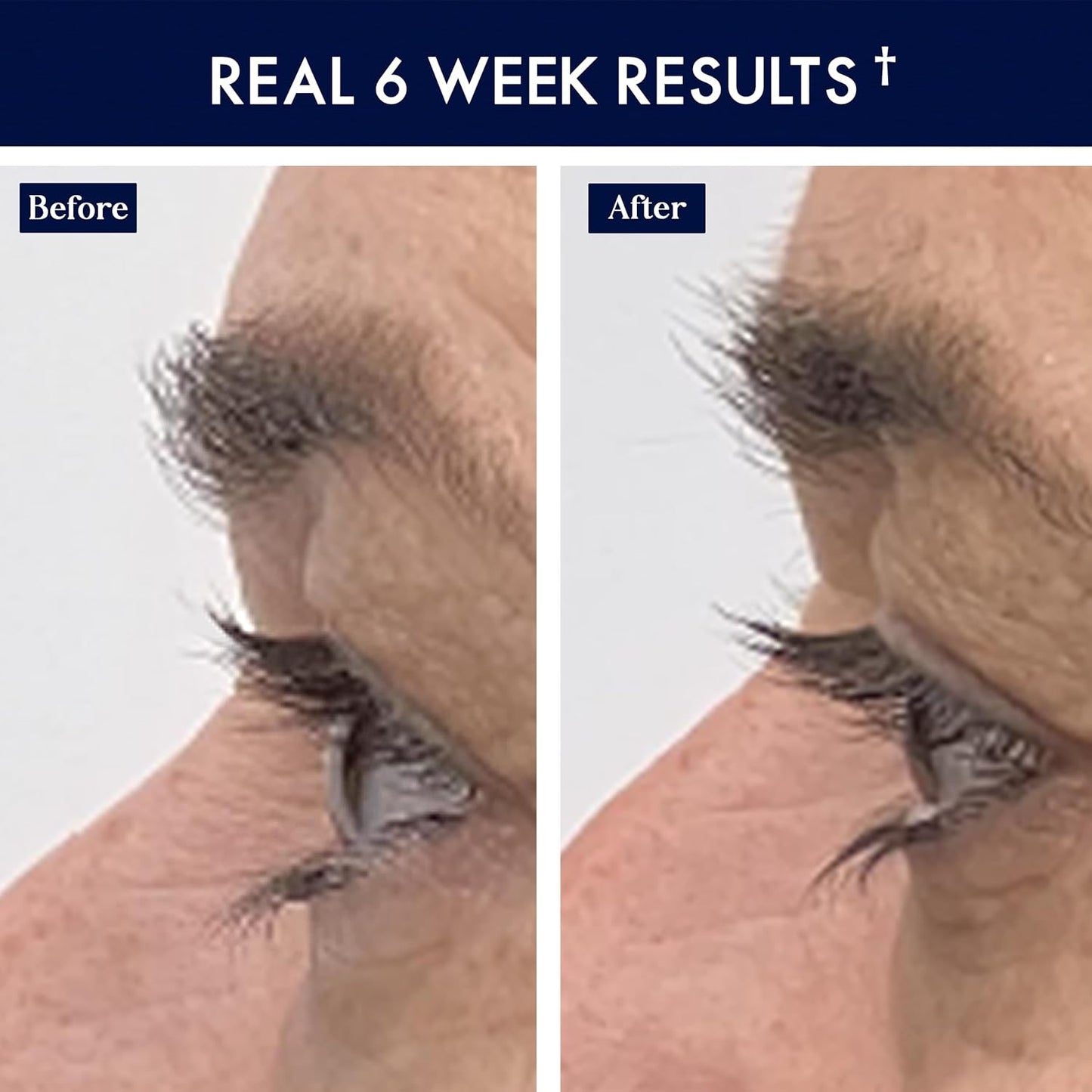 SugarbearPRO LashCare Vitamin Serum with Peptides MSM and Biotin | Vegan Formula | 3 Month Supply for Fuller Healthier Looking Lashes