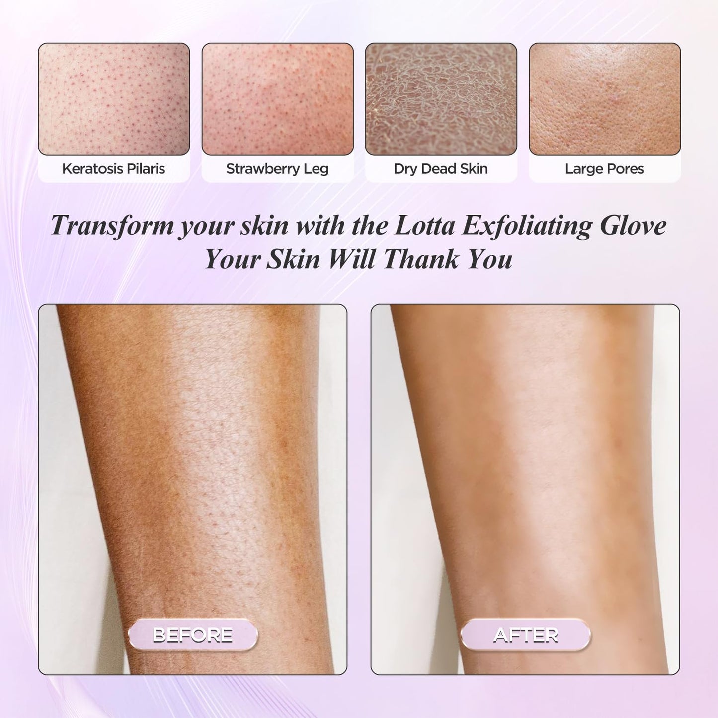 LOTTA Exfoliating Gloves 2Pcs Deep Exfoliation Mitt of 150D Shower Body Scrub Exfoliant Scrubber Glove Skin for Cleanse Dead or Dry Skin 100% Viscose Fiber Suitable for Men and Women