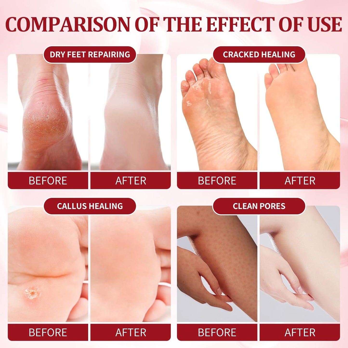 Pedicure Kit Foot Soak Set: Bubble Salt, Sugar Scrub, Massage Mask, Massage Lotion in a Box, 4 Step Foot Spa Kit for Dry Feet,Tired Feet(3 Set Pomegranate)