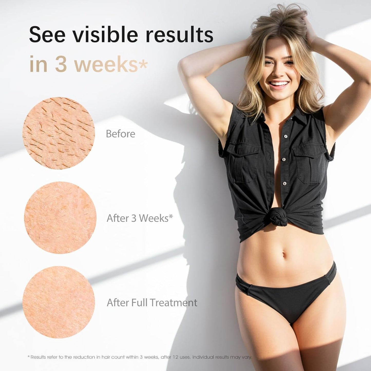 Laser Hair Removal, IPL Laser Hair Removal Device for Women & Men, Safe at-Home Nearly Painless 45°F Ice-Cooling Contact, Long-Lasting Result for Full Body & Face, Dark Green