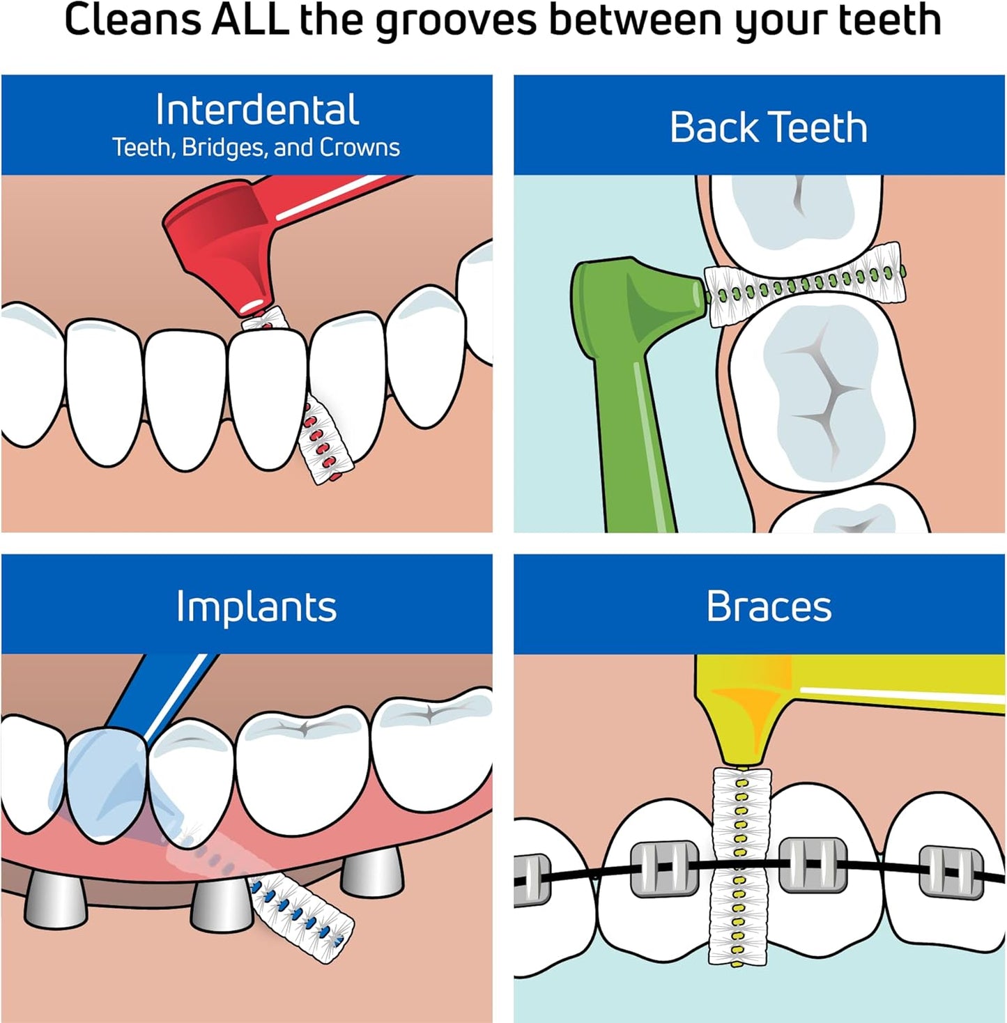 TePe Interdental Brush Angle, Angled Dental Brush for Teeth Cleaning, Pack of 25, 0.8 mm, Large Gaps, Green, Size 5
