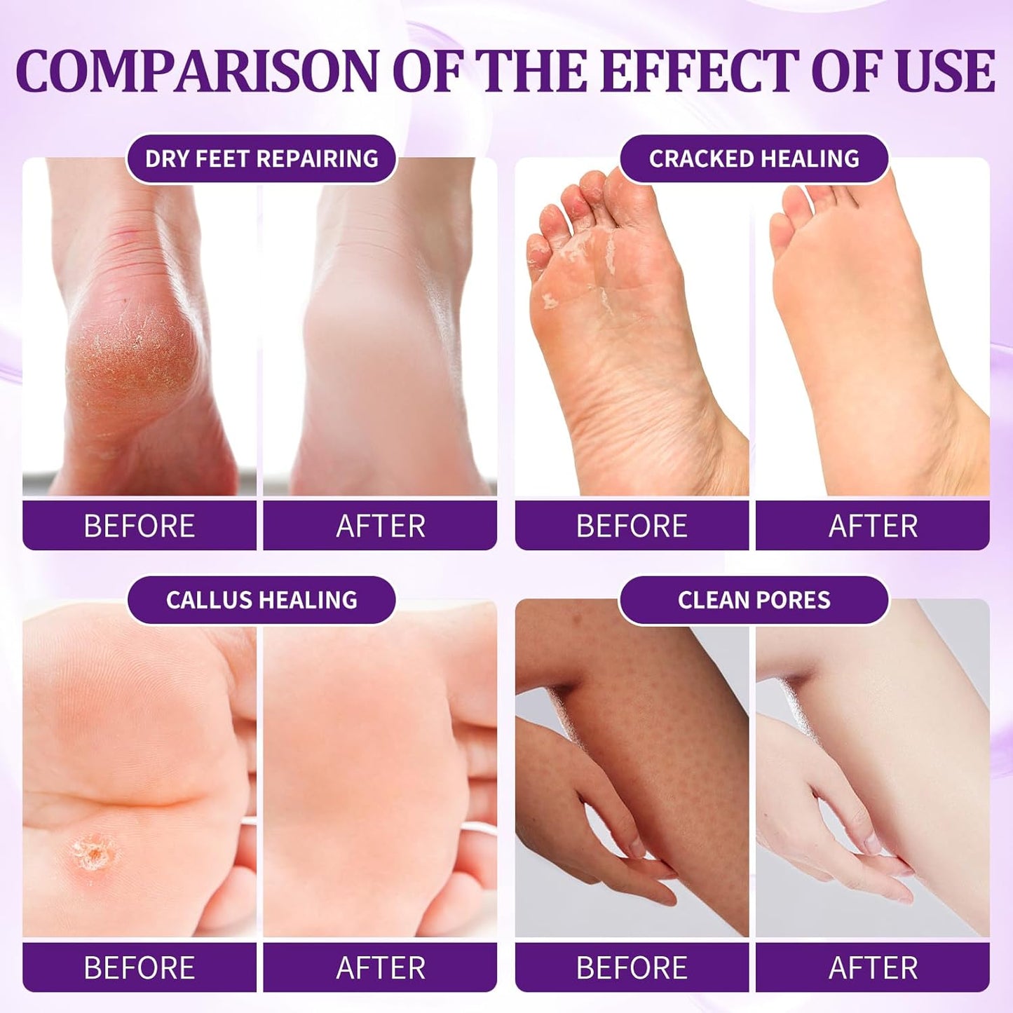 Pedicure Kit Foot Soak Set: Bubble Salt, Sugar Scrub, Massage Mask, Massage Lotion in a Box, 4 Step Foot Spa Kit for Dry Feet,Tired Feet(1 Set Lavender)