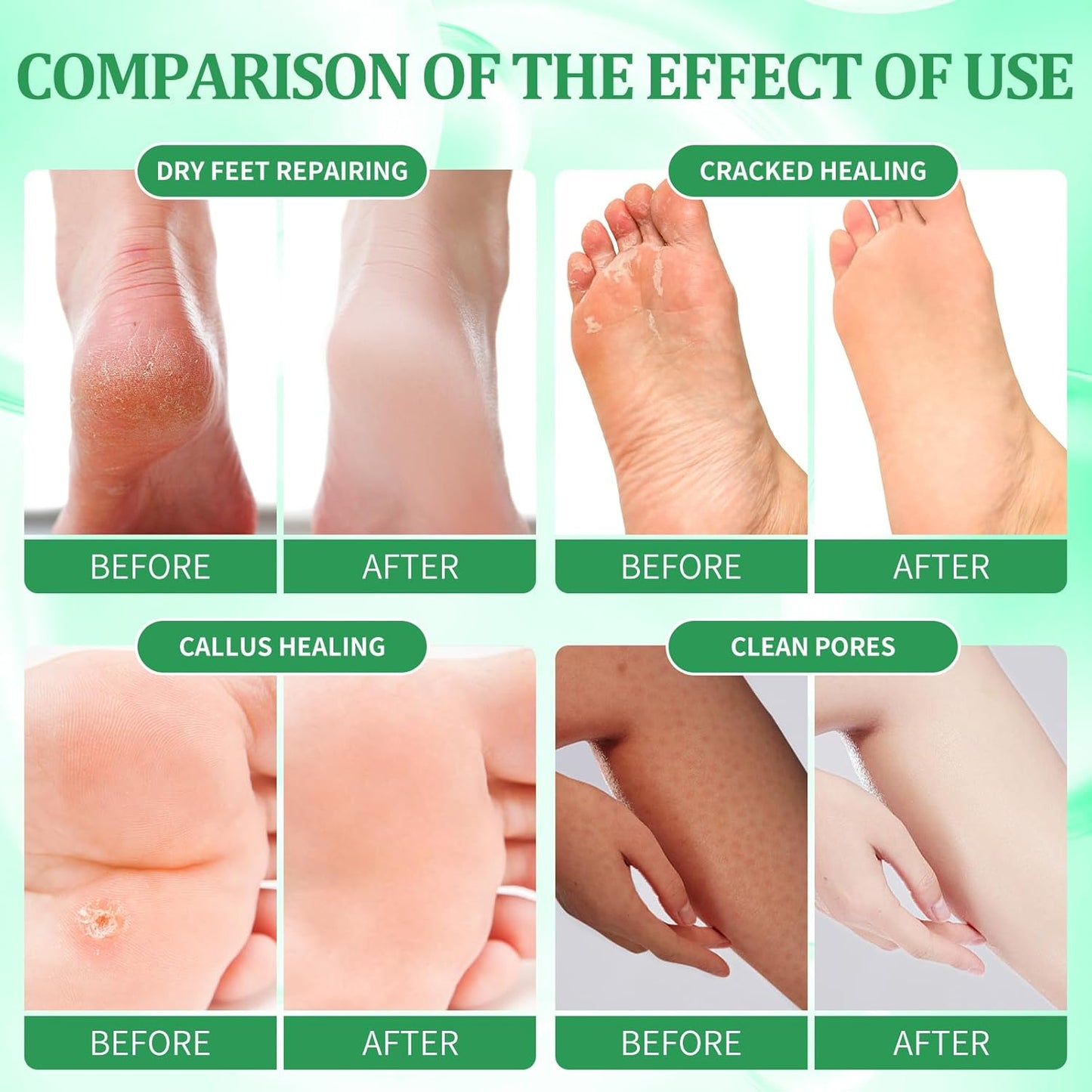 Pedicure Kit Foot Soak Set: Bubble Salt, Sugar Scrub, Massage Mask, Massage Lotion in a Box, 4 Step Foot Spa Kit for Dry Feet,Tired Feet(3 Set Eucalyptus)