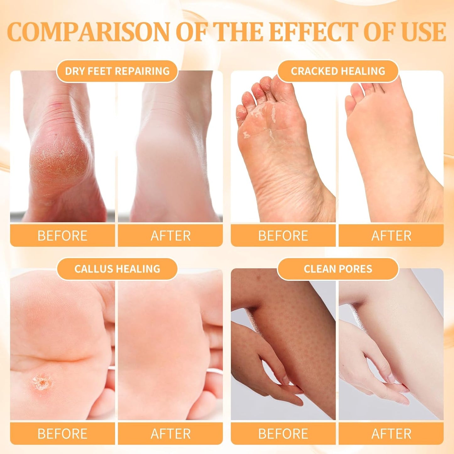 Pedicure Kit Foot Soak Set: Bubble Salt, Sugar Scrub, Massage Mask, Massage Lotion in a Box, 4 Step Foot Spa Kit for Dry Feet, Softens Calluses and Tired Feet(1 Set Orange)