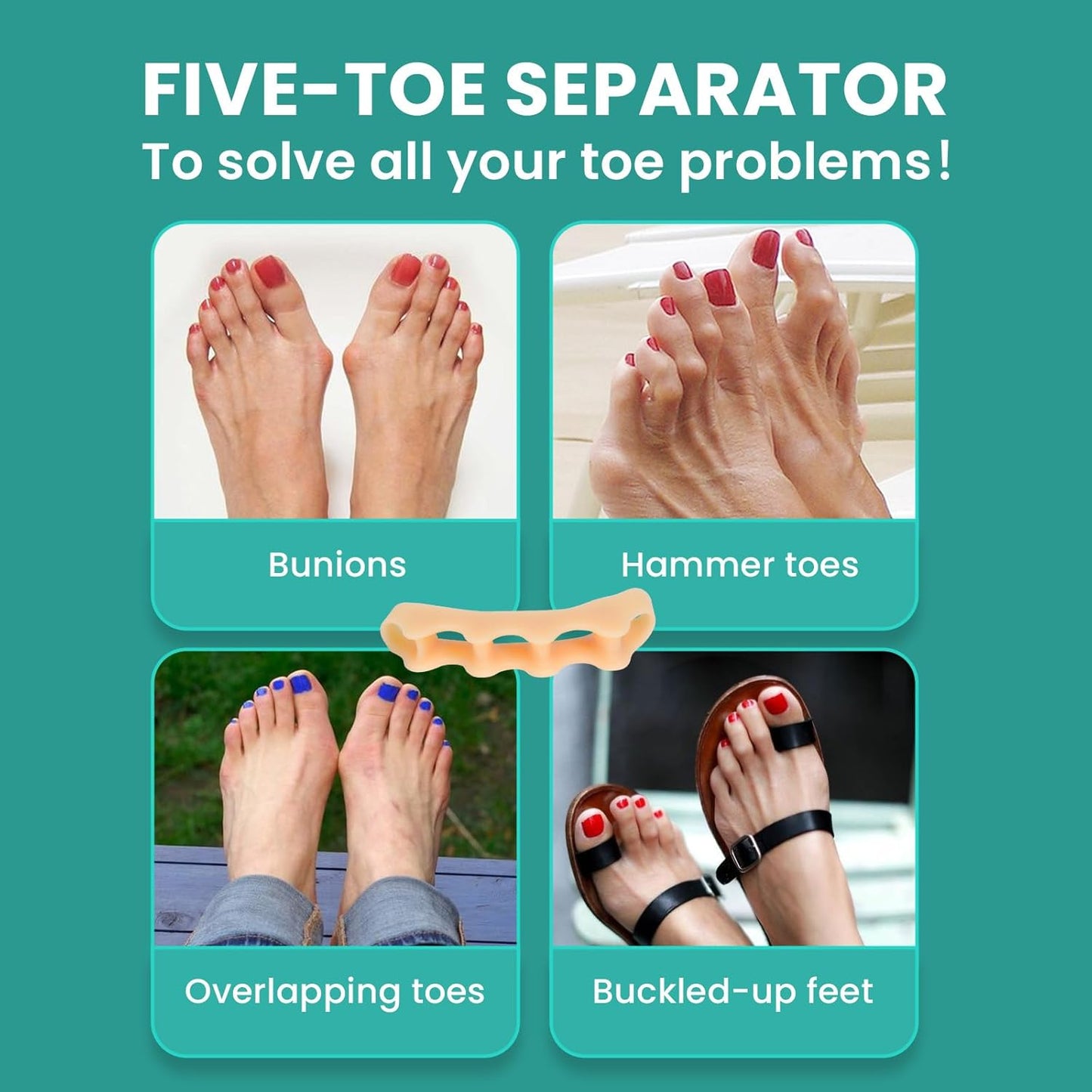 Welnove Toe Separators Bunion Corrector - Toe Spacers for Men Women to Correct Bunions and Relieve Foot Pain - Silicone Toe Spacers for Toe Overlapping Hammertoe Yoga Practice - Beige,8 Pack