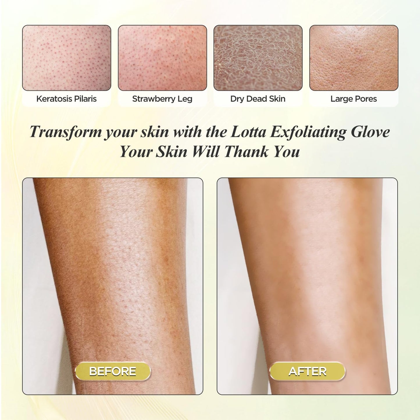 LOTTA Deep Exfoliating Mitt 2pcs - Body Scrub Korean Gloves for Dead Skin Removal & Keratosis Pilaris Treatment - Improve Skin Tone, Body Exfoliator for Shower & Skincare Routine