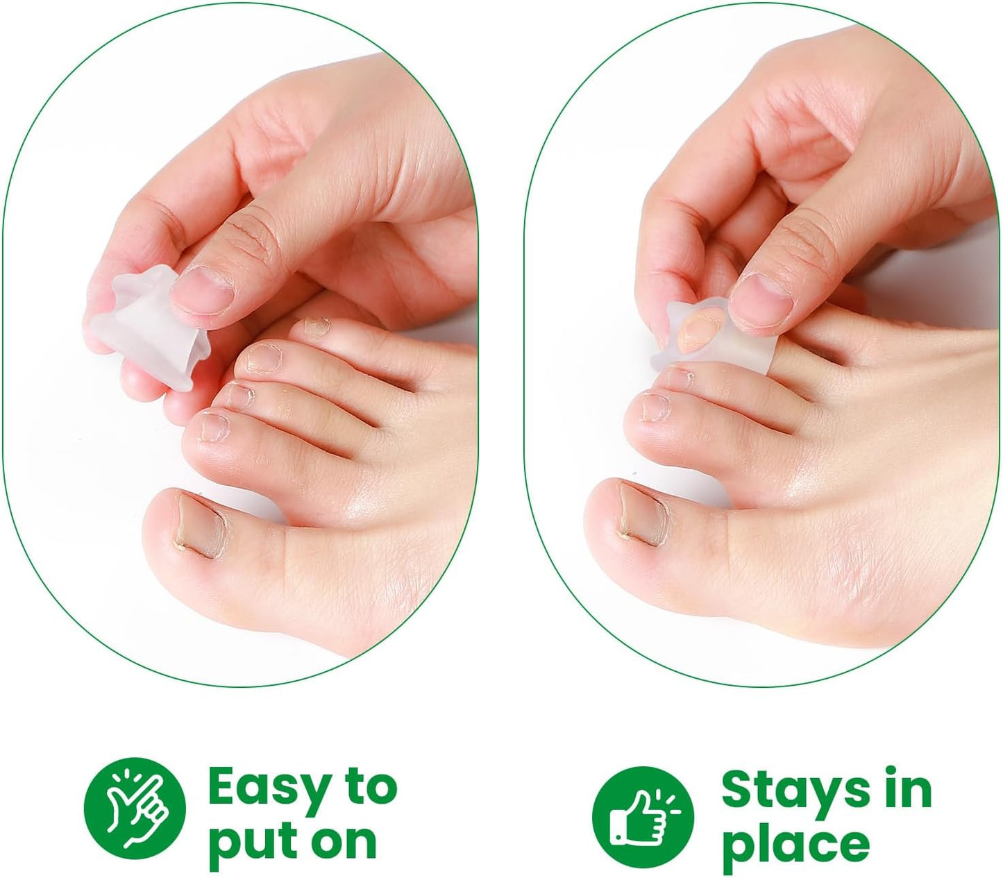 Bukihome Hammertoe Corrector - 6 Pack Toe Straightener to Curled Toes, Broken toe, Bunion Corrector for Women and Men, Small Size (Clear)