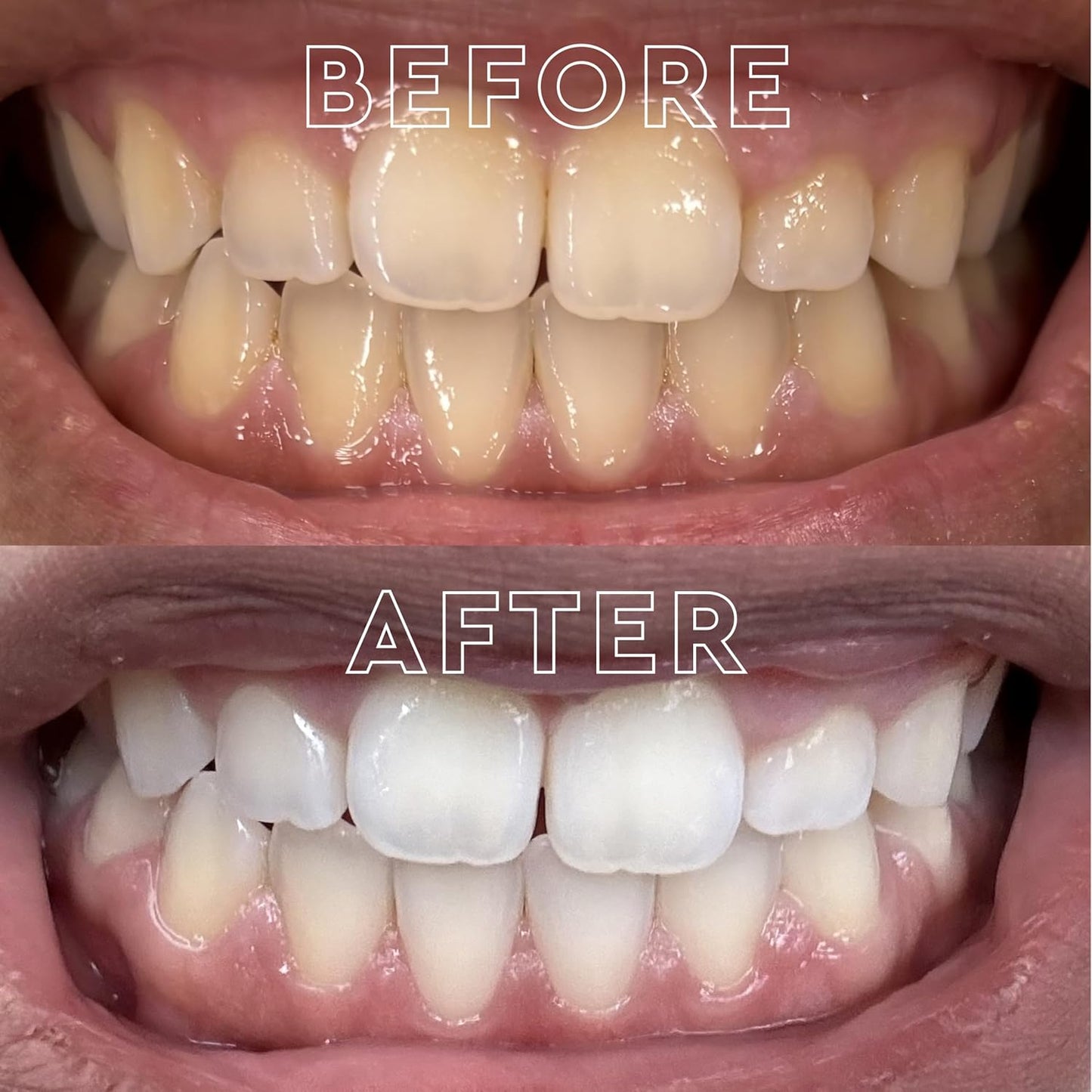 MOON Dissolving Teeth Whitening Strips - Vegan, Easy-to-Use White Strips - Dissolve in 15 Minutes & Designed to Gently Whiten Sensitive Teeth Up to 7 Shades in 2 Weeks, Midnight Mint (56 Count)