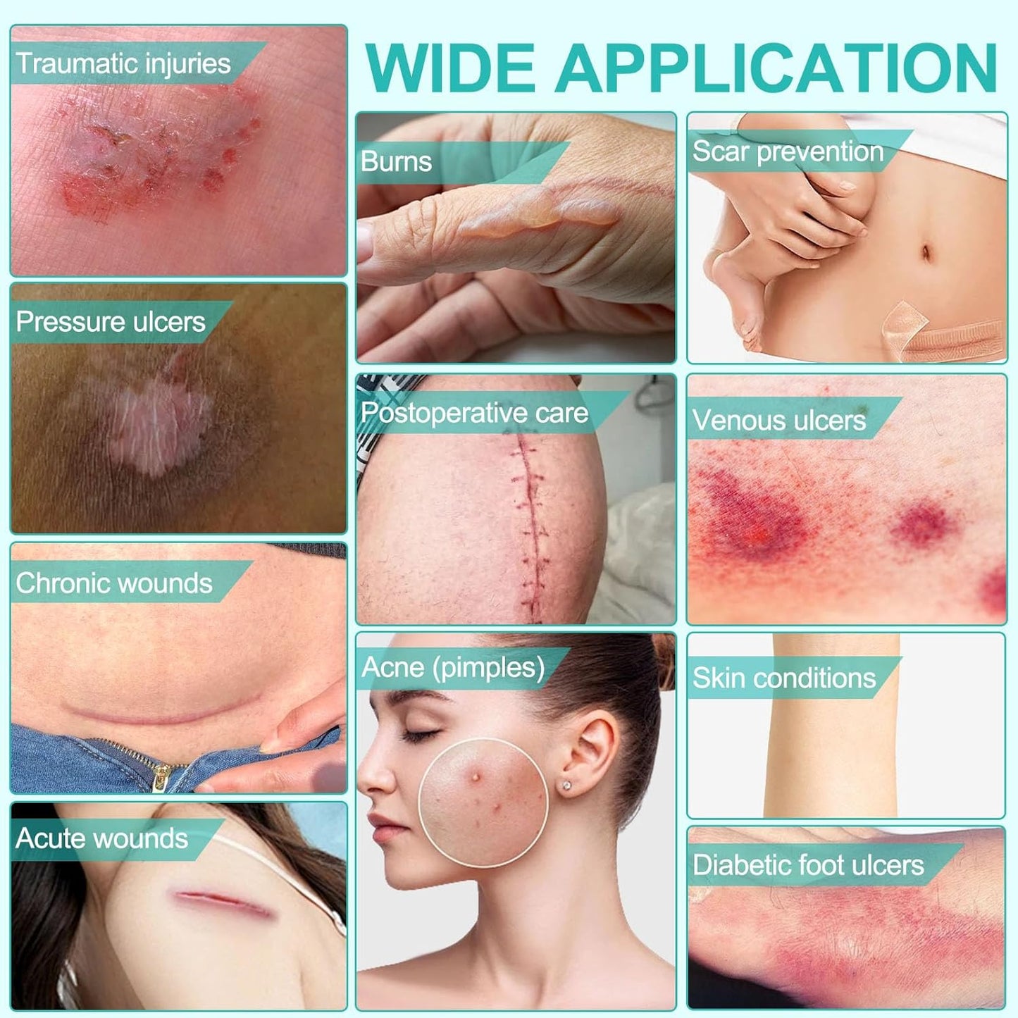 Hydrocolloid Roll, Medical-Grade Hydrocolloid Bandages for Wound Care, Extra Large Hydrocolloid Patch Bandages with Self-Adhesive, Cut-to-Size, Flexible Waterproof,First Aid Kit Essential(2in*16.4ft)