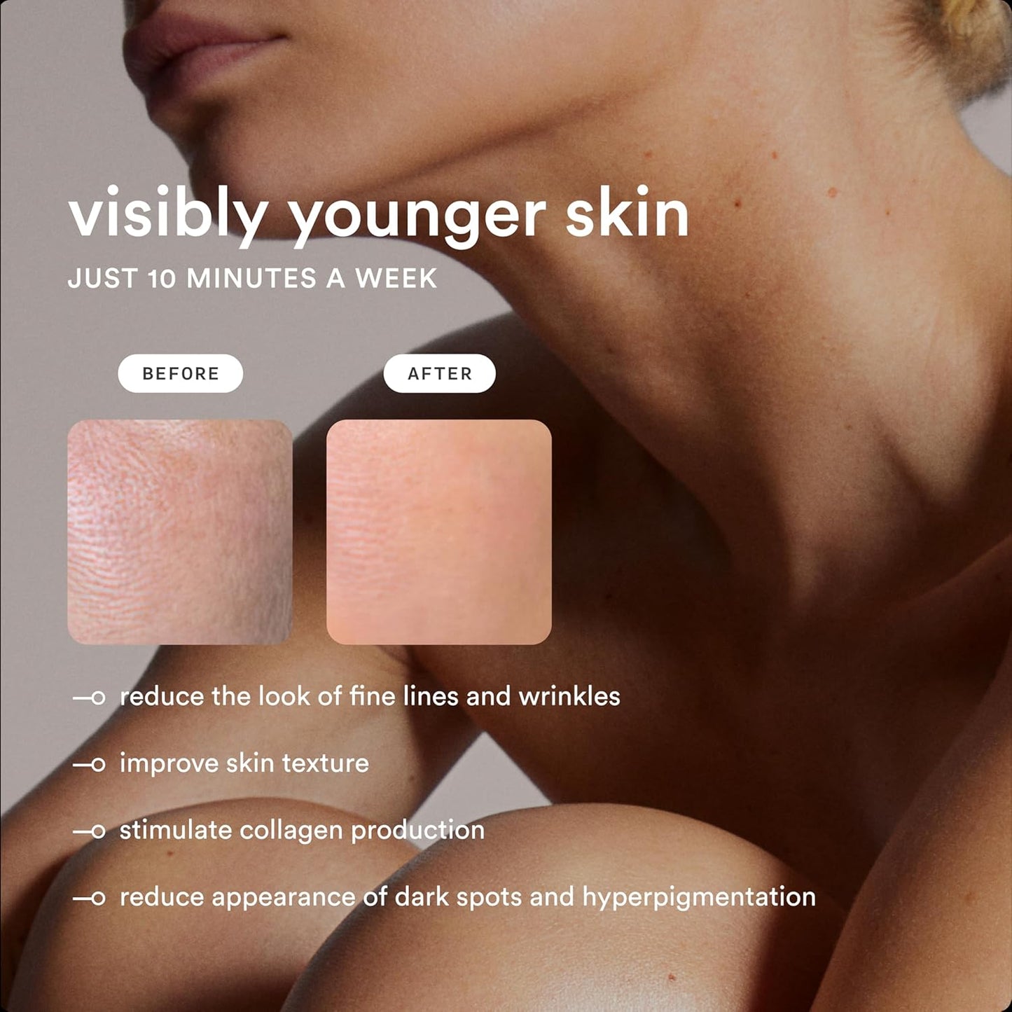 NEW Nood™ Flasher Pro — IPL Laser Hair Removal Device for Women & Men with Sapphire Cooling — Pain-free & Permanent, Visible Results After First Use & Works Everywhere Hair Grows — Matte Black