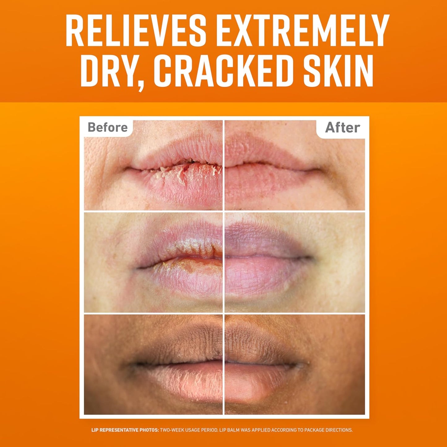 O'Keeffe's Lip Repair Lip Balm Set for Dry, Cracked Lips - Stick (Pack of 3: 1 Cooling + 1 Unscented + 1 SPF) - Moisturizer for for Extremely Cracked, Dry Lips