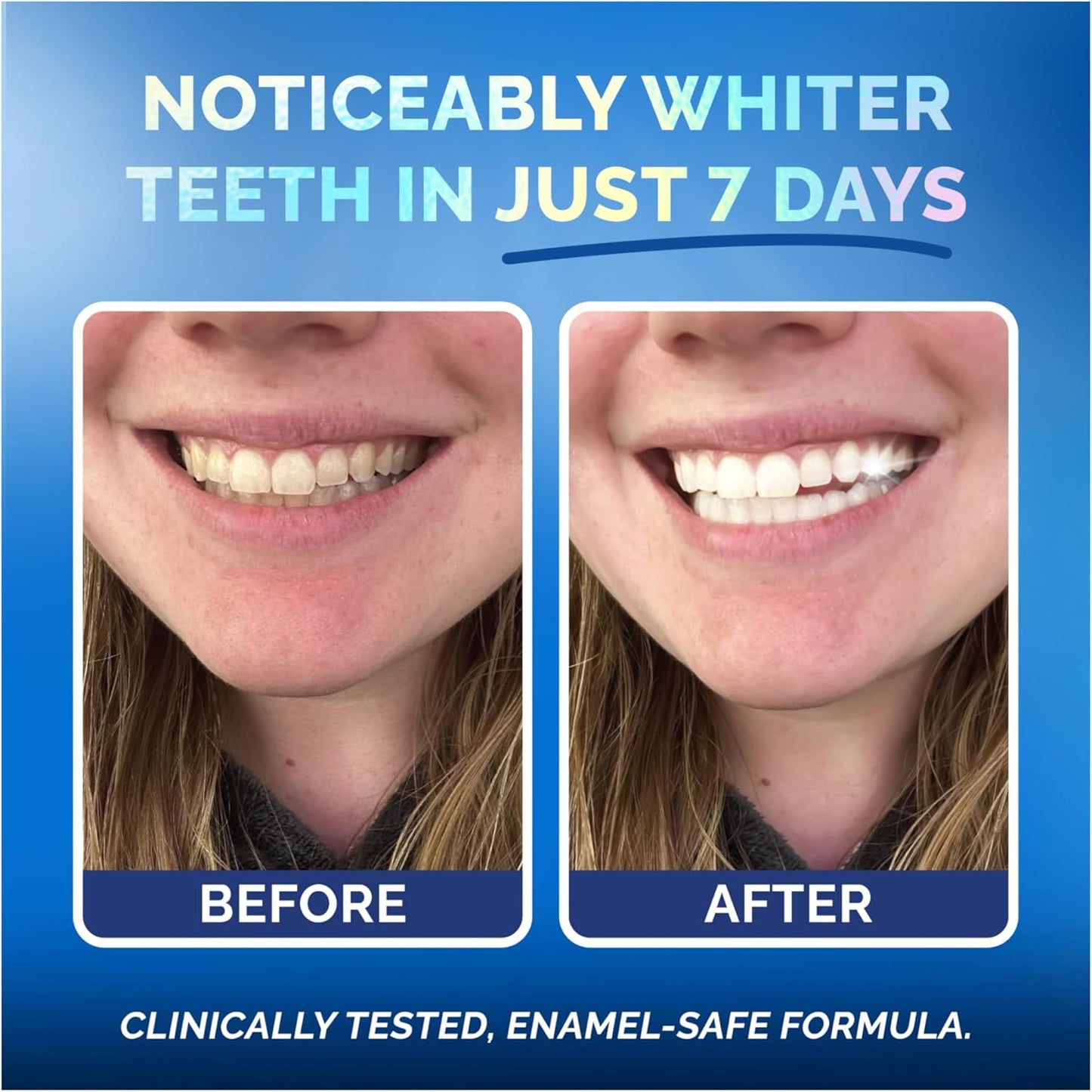 Whitening Strips for Sensitive Teeth – Enamel Safe, Peroxide-Free Coconut Teeth Whitening Strips with Natural Enzymes – Gentle White Stips for Sensitive Gums (28 Count (Pack of 1), Mint)