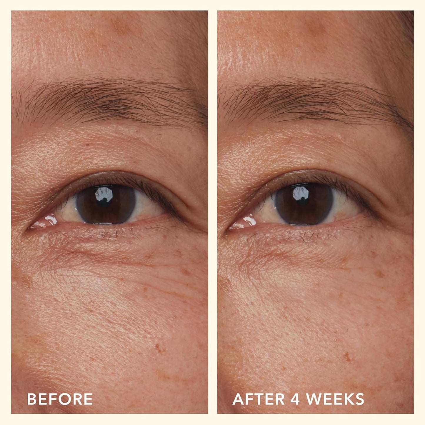 Beekman 1802 Mushroom Goat Milk Eye Cream - Clinically Proven Anti-Aging Eye Treatment for Dark Circles & Fine Lines - With Kojic Acid, Hexapeptide & Mushrooms - Fragrance-Free, Cruelty-Free