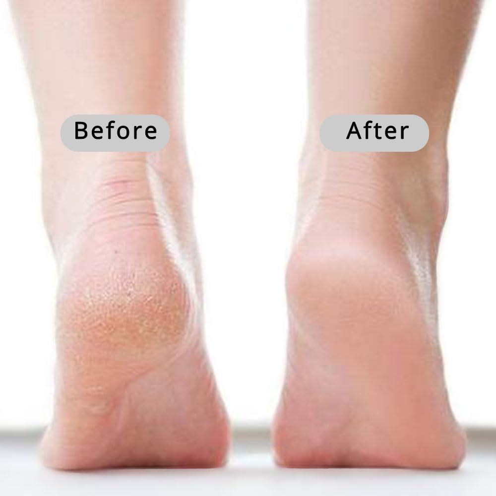 Natural Volcanic Stone Foot Pumice Stone - 14" Straight Handle Callus Remover for Dry Cracked Feet - Firm Grip Exfoliator, Pedicure Tool for Seniors & Arthritic Hands