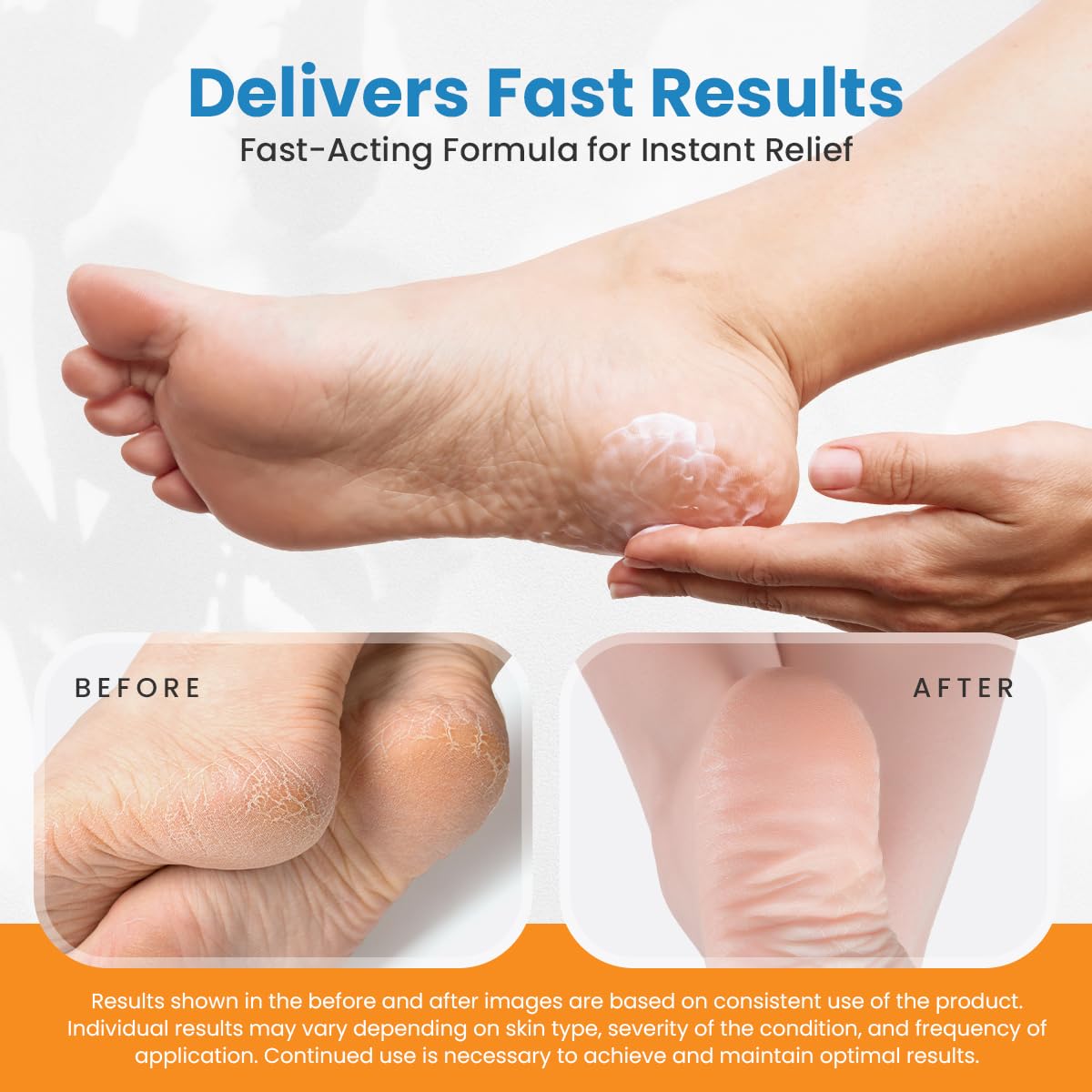 Revitaderm 4D Urea Cream 40% for Feet, Intensive Moisturizing Foot Cream for Dry, Rough, Callused Skin, Includes Free Pumice Stone and Exfoliating Brush, Fast-Absorbing, Fragrance-Free, 4oz, 10 Pack