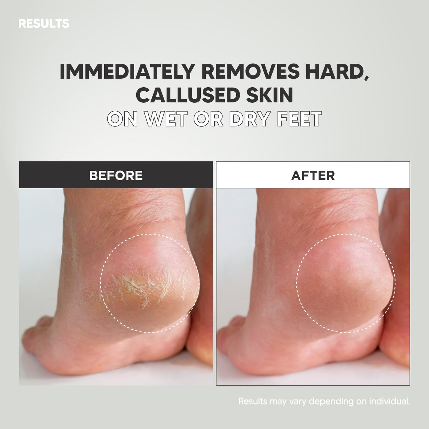 Wide Emery Foot File(Pink), Double-Sided Pedicure Tool, Colossal Professional Foot Scrubber for Men & Women, Effective for Cracked Heel, Callus Remover