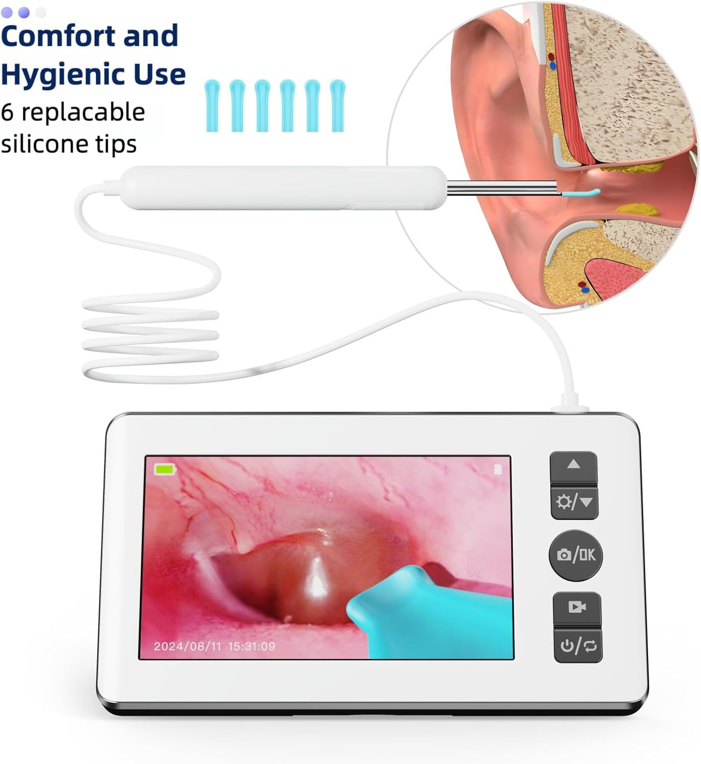 Ear Wax Removal Kit with Camera | Ear Cleaner with 4.3" IPS Display, 1080P HD, 2500mAh Battery, Silicone Tips | Standalone Tool, No Phone Required