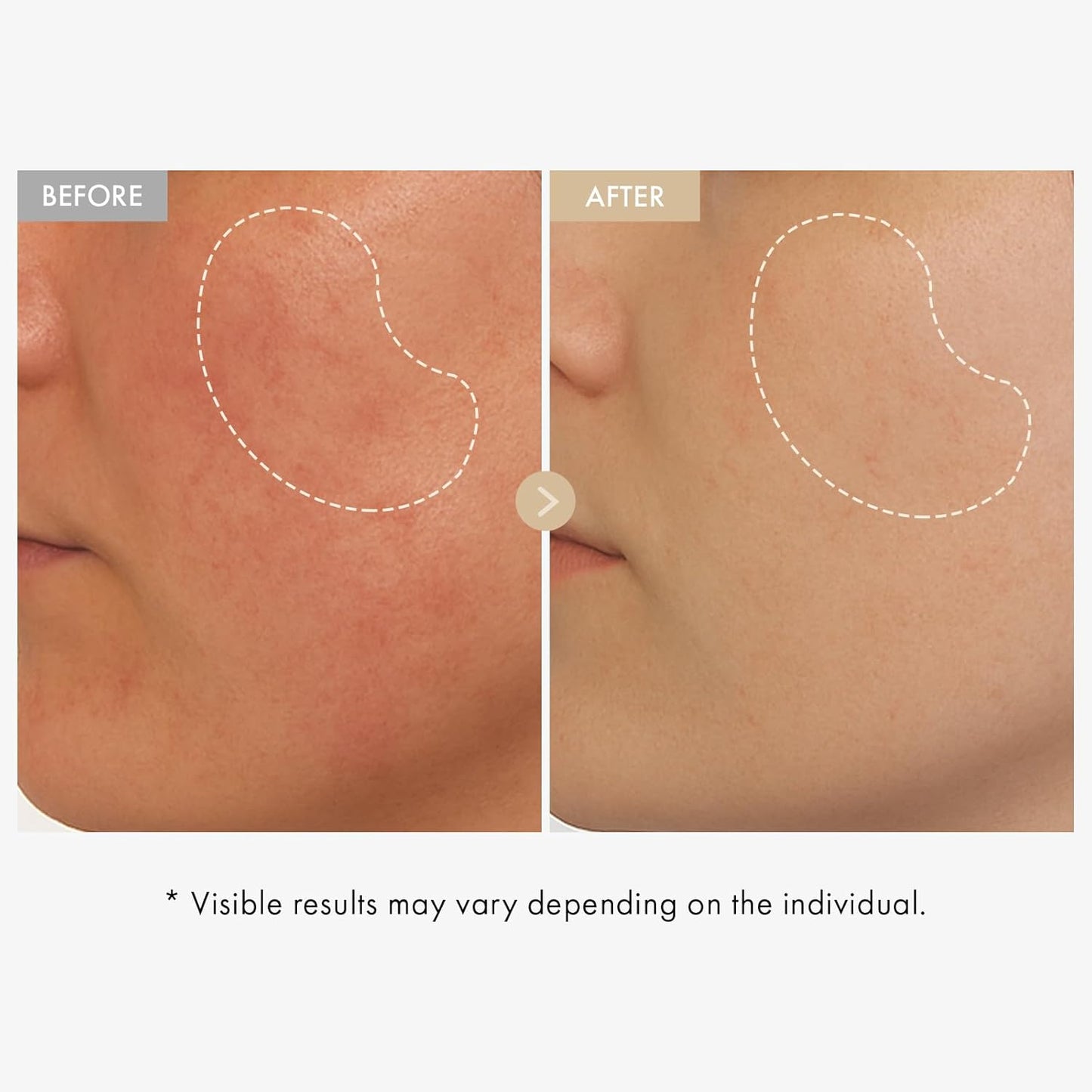 TOSOWOONG Real Rice Glow Serum with 80% Rice Bran Water and Niacinamide for Dark Spots, Uneven Skin Tone, Dull Skin, Radiant Glow, and Daily K-Beauty Skincare for All Skin Types, 33ml / 1.11 fl. oz.