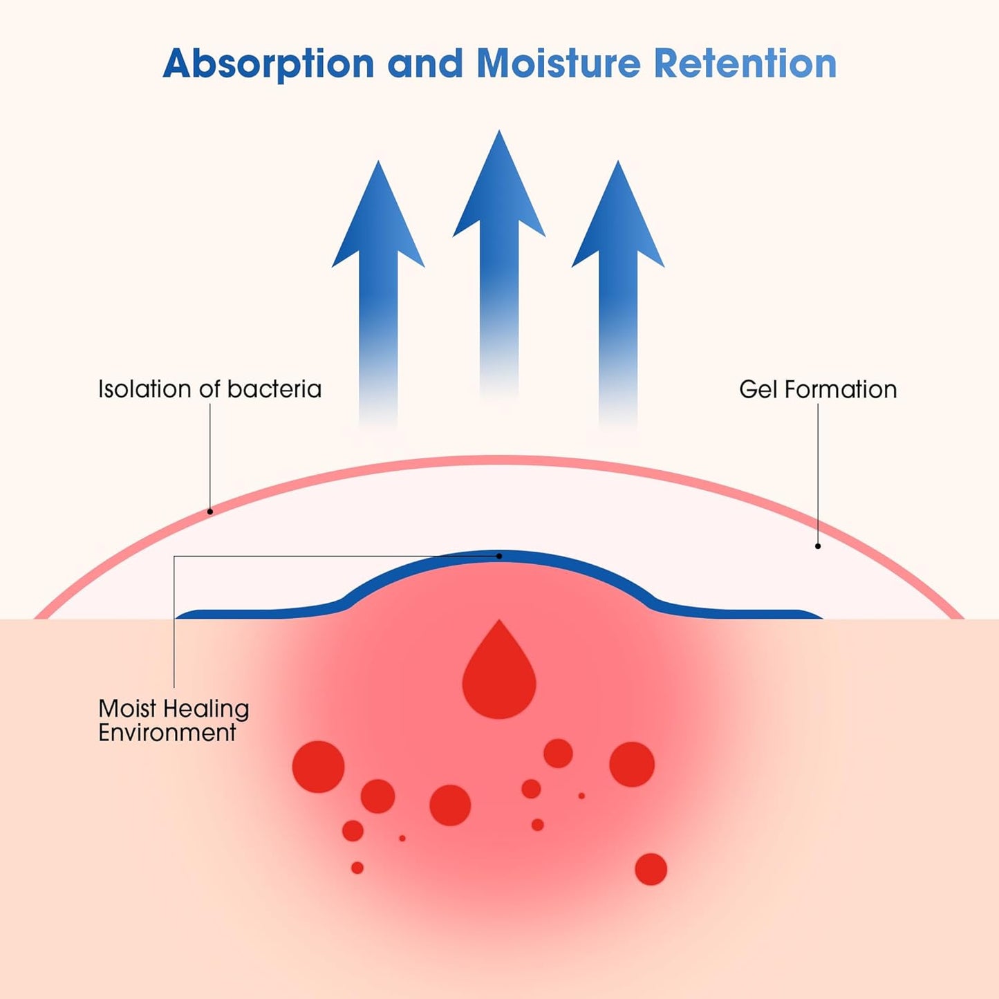 Hydrocolloid Bandages 2" x 2", Waterproof Dressing with Self-Adhesive for Light Exudate Wound, Blister, Acne, Bordered Hydrocolloid Patches for Bed Sores, Abrasions, 20 Pack