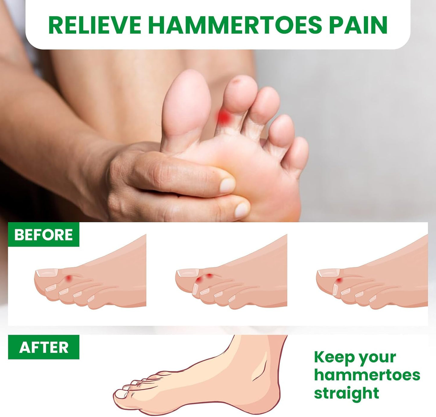 Bukihome Hammertoe Corrector - 6 Pack Toe Straightener to Curled Toes, Broken toe, Bunion Corrector for Women and Men, Medium Size (Clear)