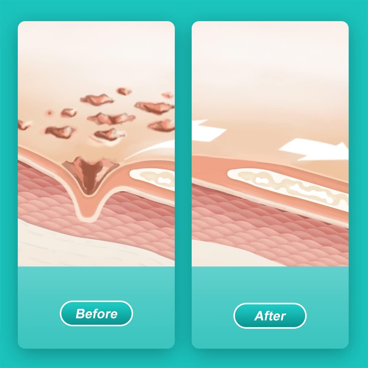 Dimora 2 Packs 6oz Hydrogel First Aid Ointment, Burn Injory Soothing Gel, Skin Repair Cream for Emergency Burn, Postoperative Incisions, Bruises, Debridement Wound Care