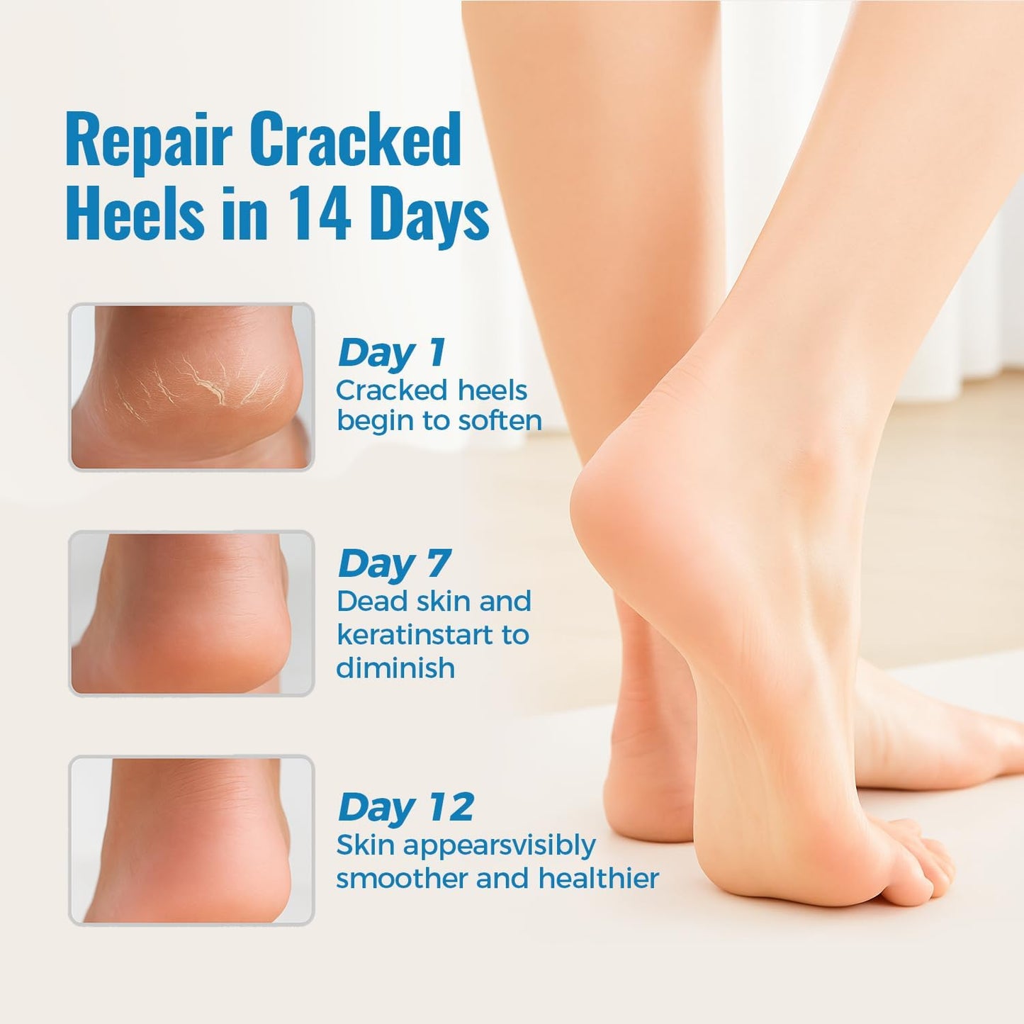 2 Pairs Moisturizing Gel Toeless Socks for Dry Feet Cracked Heel Stick Repair Treatment Women Hydrating Foot Spa Moisture Softens Reusable Pedicure Sock