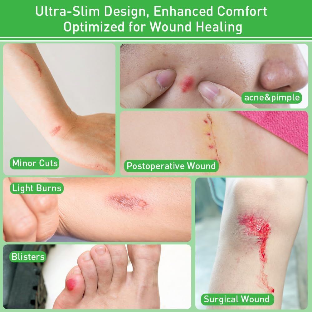 2in*16ft Hydrocolloid Roll for Wound Care,Large Hydrocolloid Bandages Patch with Self-Adhesive Waterproof Ultra Absorbent Flexible DIY Size & Shape First Aid Kit Essential