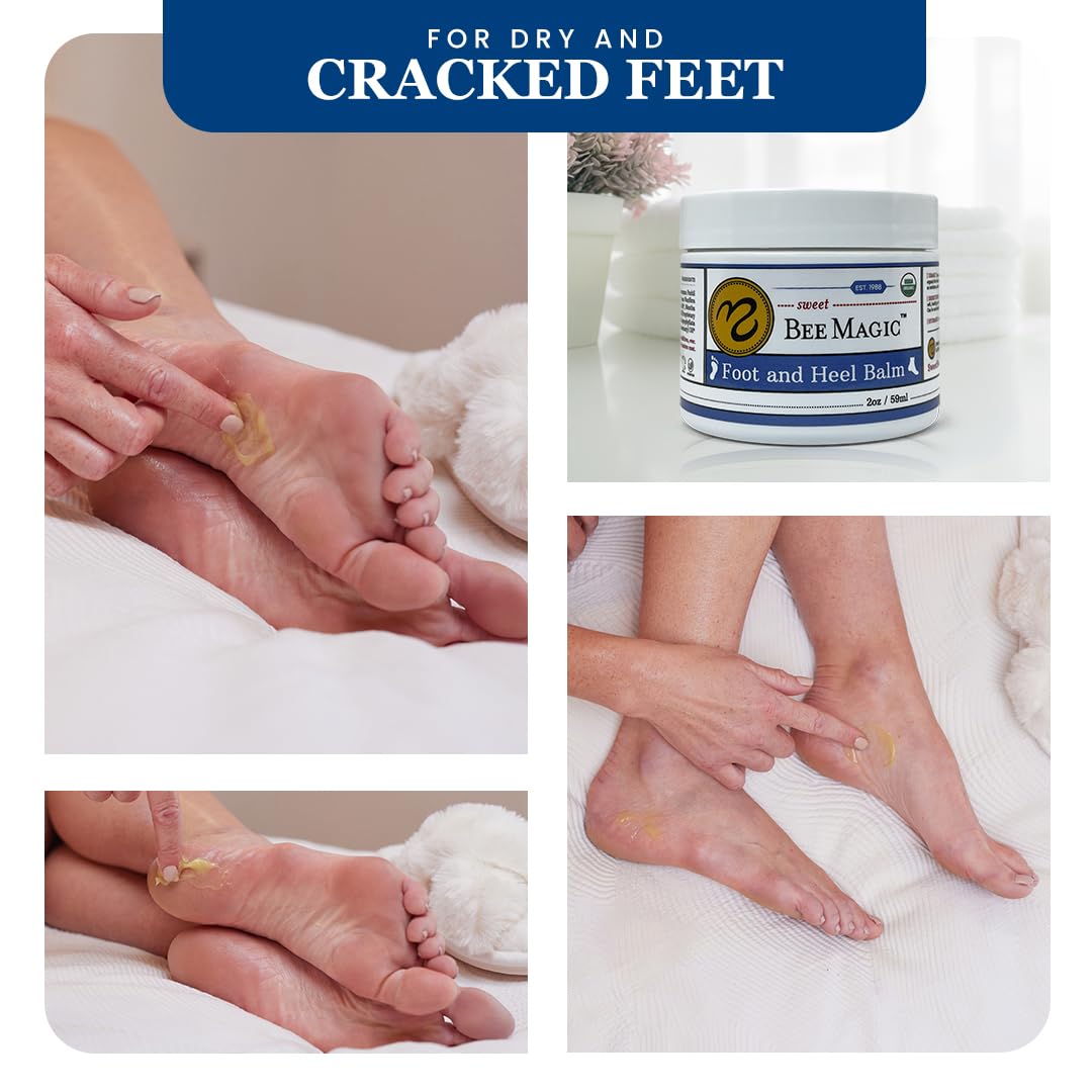 Sweet Bee Naturals Organic All Natural Foot and Heel Balm 2 OZ Jar. For Dry and Cracked Feet Repair. Organic Salve Moisturizer for Heel Care & Callus Treatment. Made in USA. 1 Jar (2 OZ)